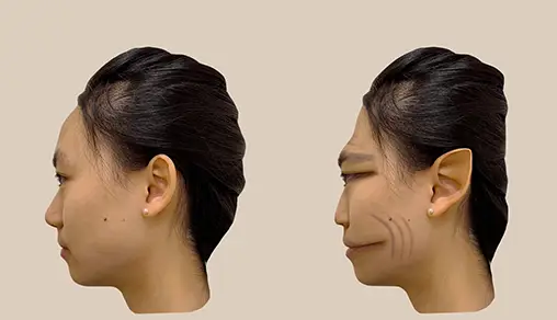 Not everyone sees the distortions the same way (Antonio Mello/The Lancet)