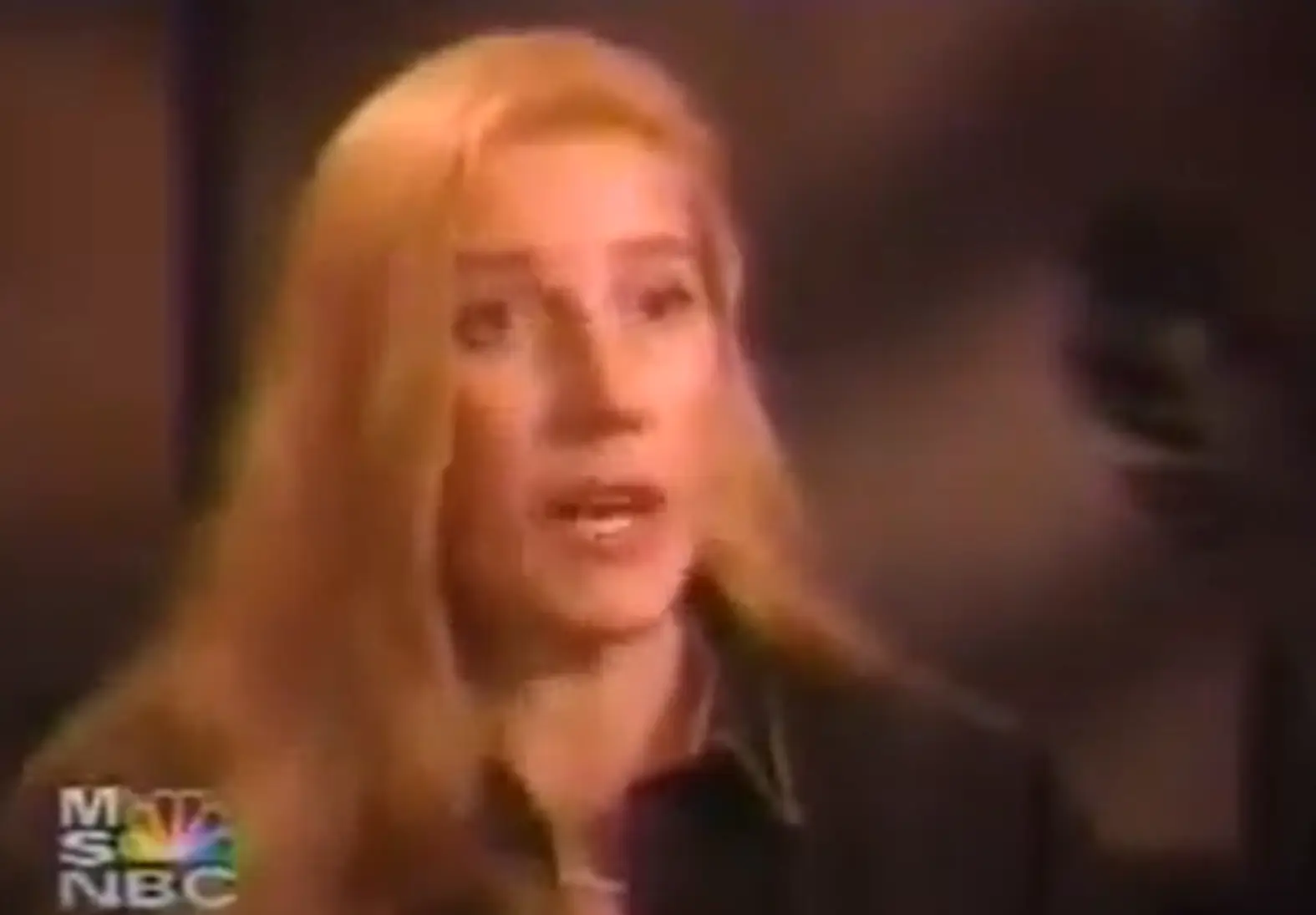 Her eyes were taped shut and she had headphones on for the procedure (NBC)