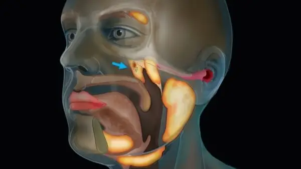 Netherlands Cancer Institute