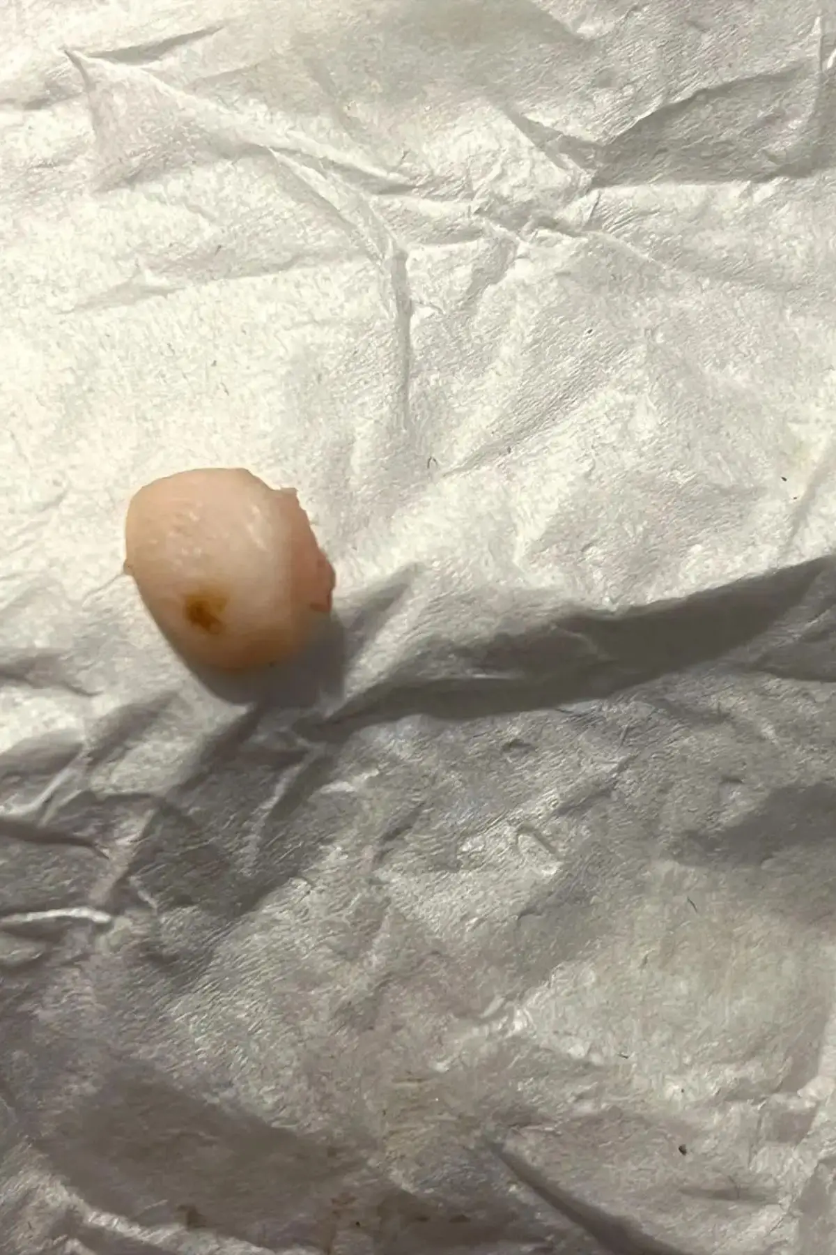 The lawsuit claiming the New York woman had found a fingertip in her food was filed earlier this month (Greenberg Law P.C.)