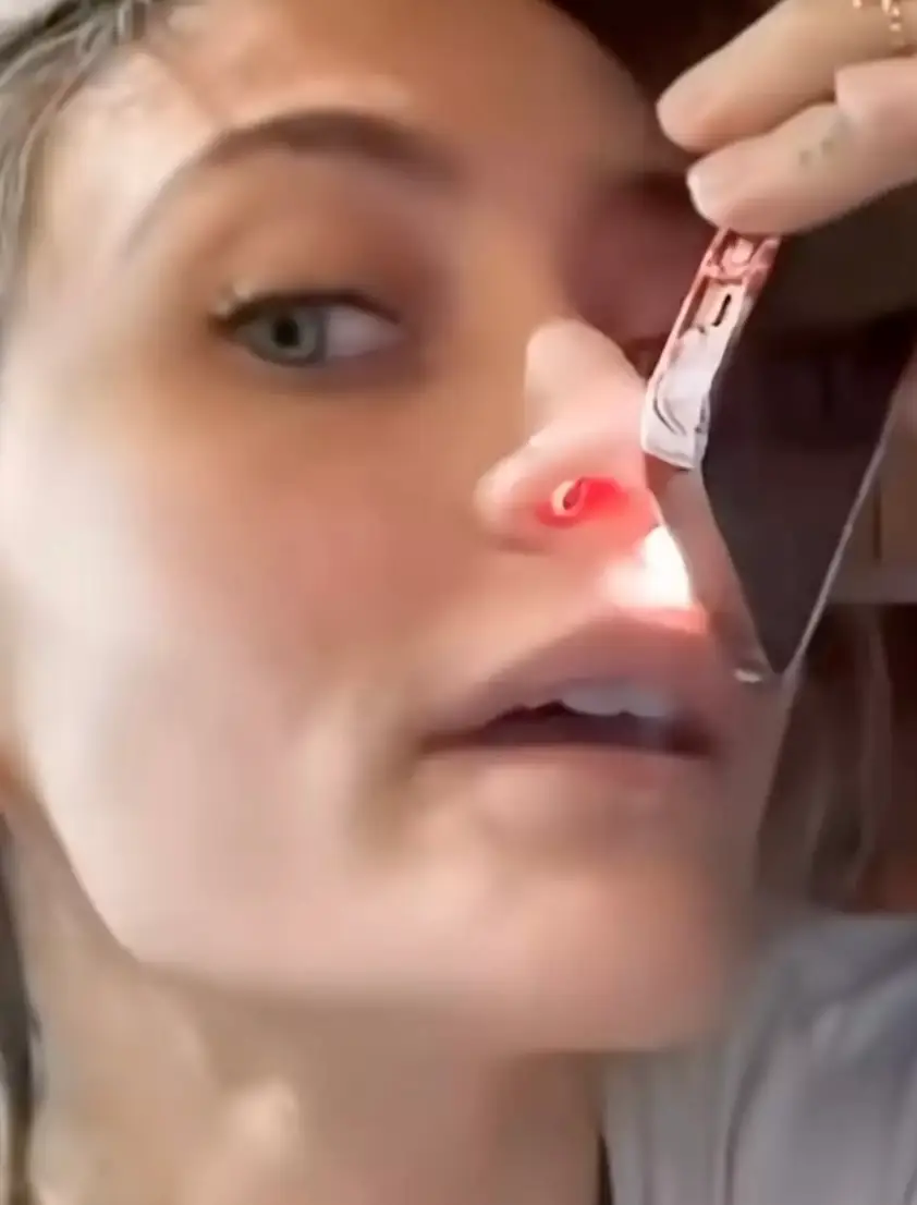 The 27-year-old revealed she has a perforated septum which causes a 'really loud' whistle when she breathes (TikTok/@parisjacksonbrasil)