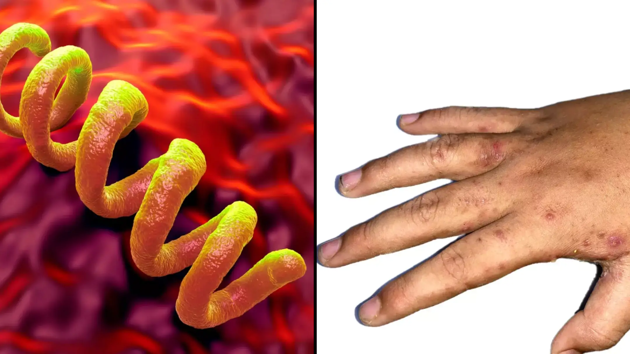 Brits warned about best way to avoid Victorian disease sweeping UK at the moment