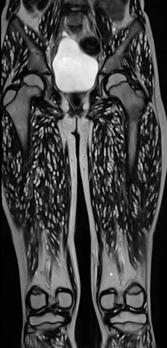 The parasite could be seen across her whole body (RSNA)