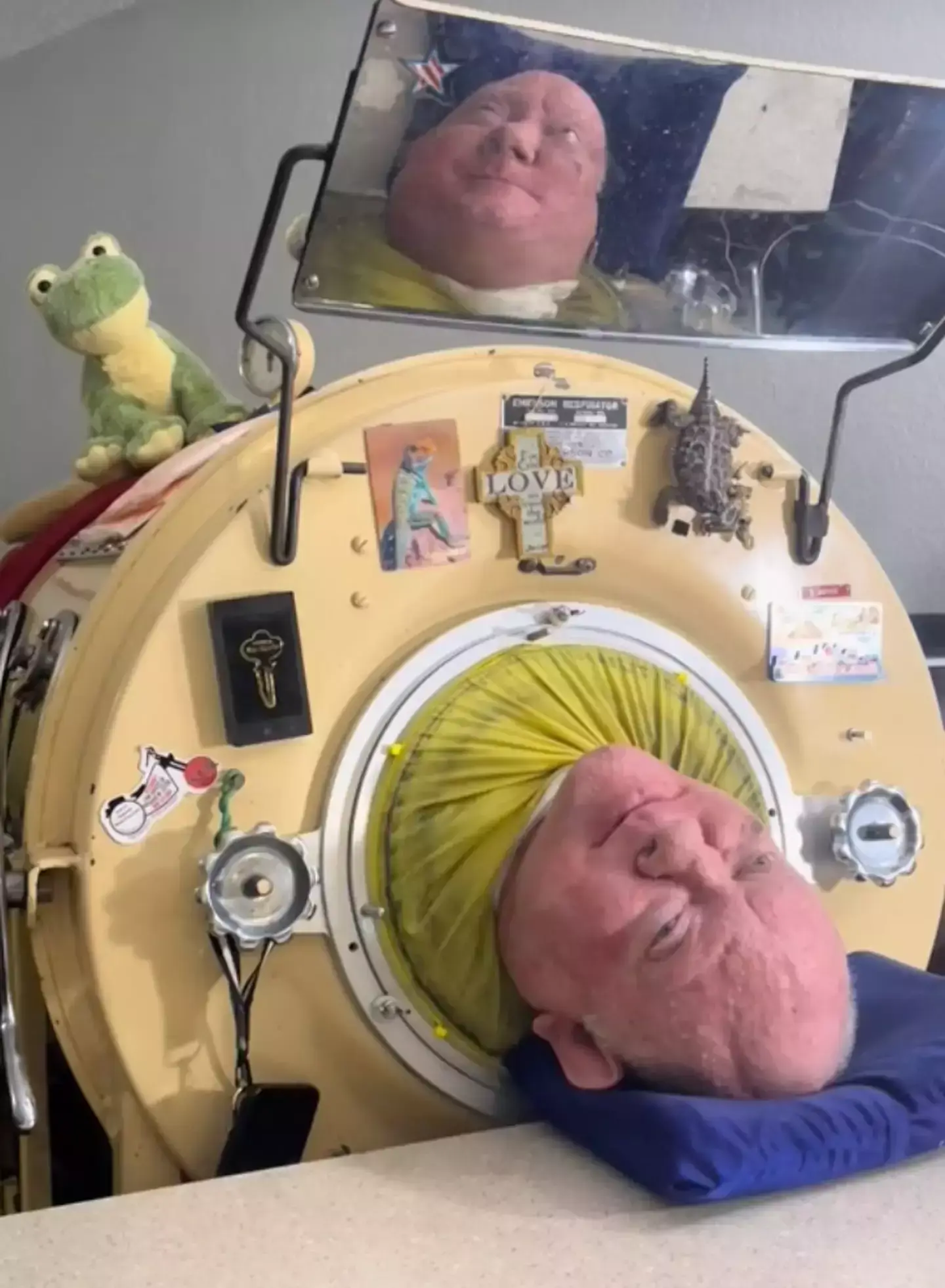 Paul Alexander inside his iron lung (TikTok/@ironlungman)