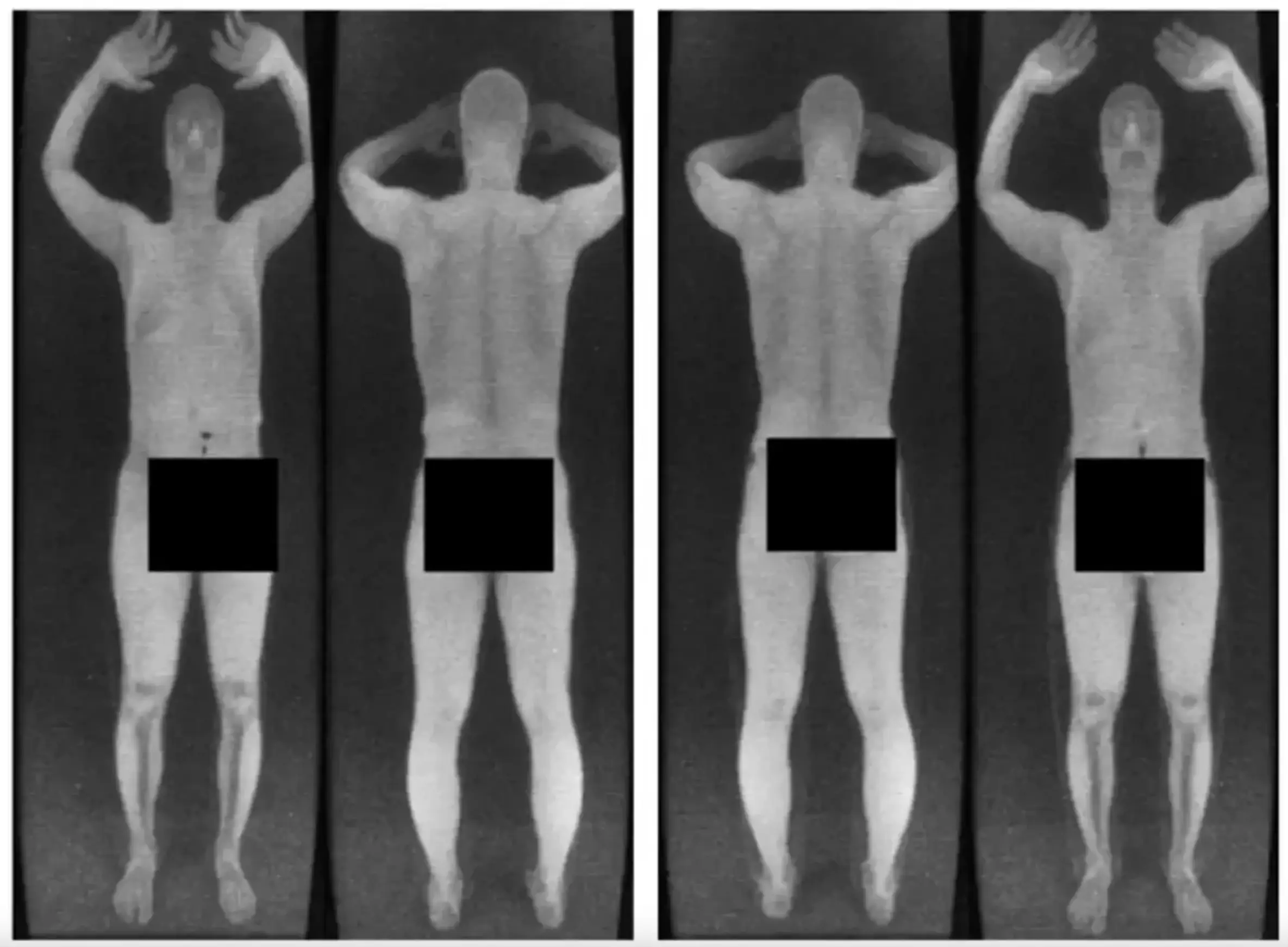 Older airport scans were extremely revealing (X /@‌greendaylover44)