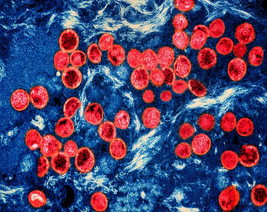 The mpox virus. (NIH-NIAID/IMAGE POINT FR/BSIP/Universal Images Group via Getty Images)