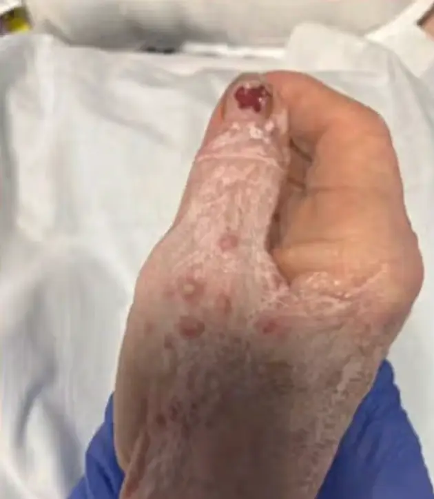Shelba Catterton family say she was left covered in ant bites (WCBD)