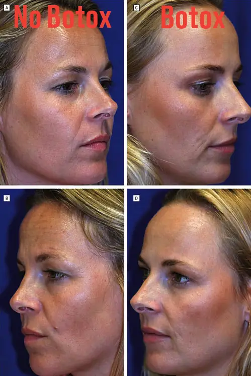 The twins proved to be ideal candidates for the study (American Medical Association)