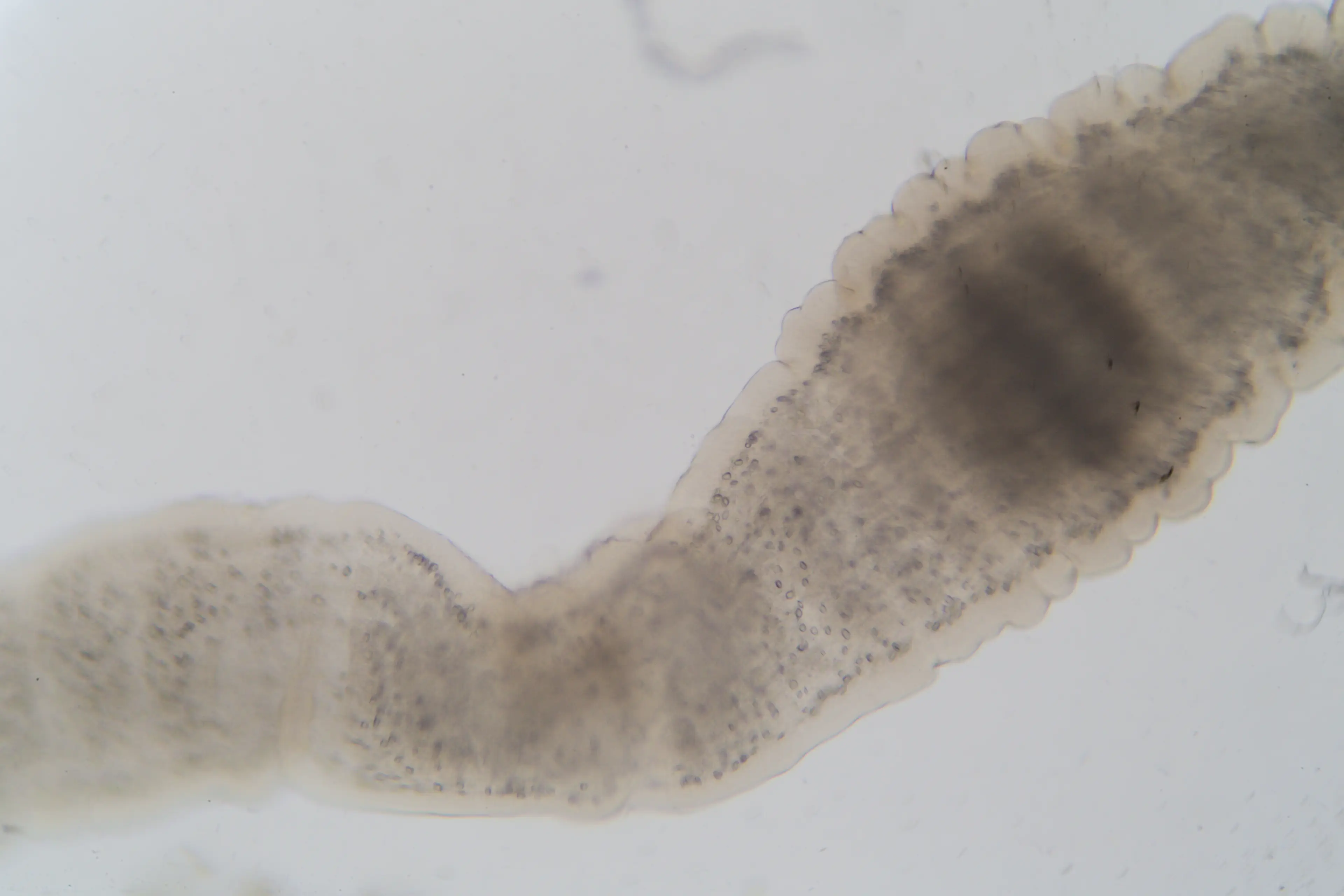 Tapeworms can infect your bloodstream with larvae (Sinhyu via Getty Images)