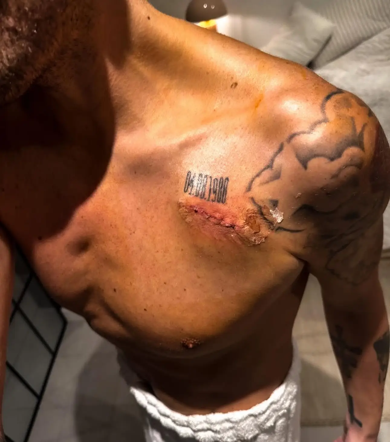 George said the second surgery was a success (Instagram / MaxGeorge)