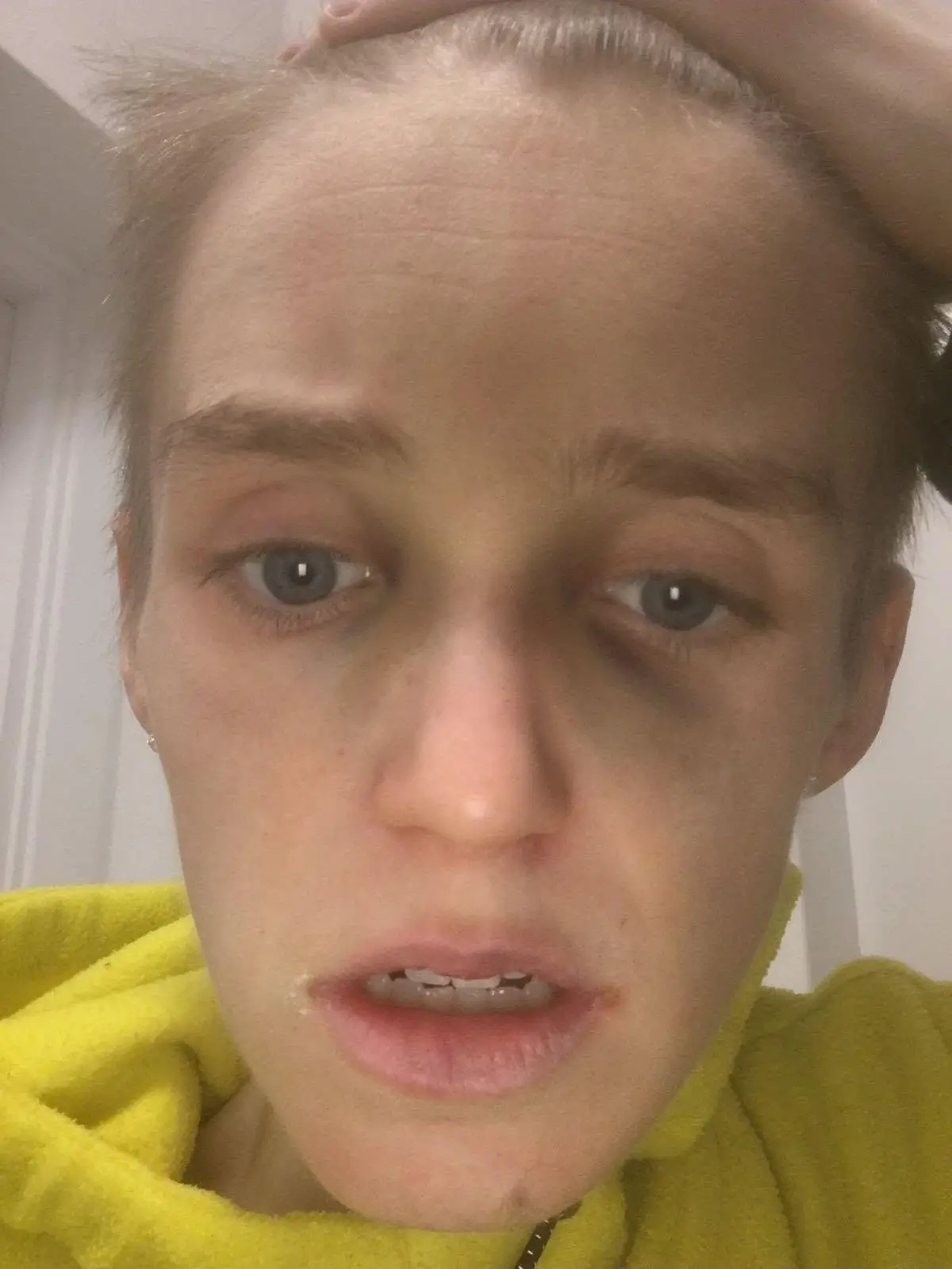 Jordan dropped to below five stone (Jordan Caldwell)