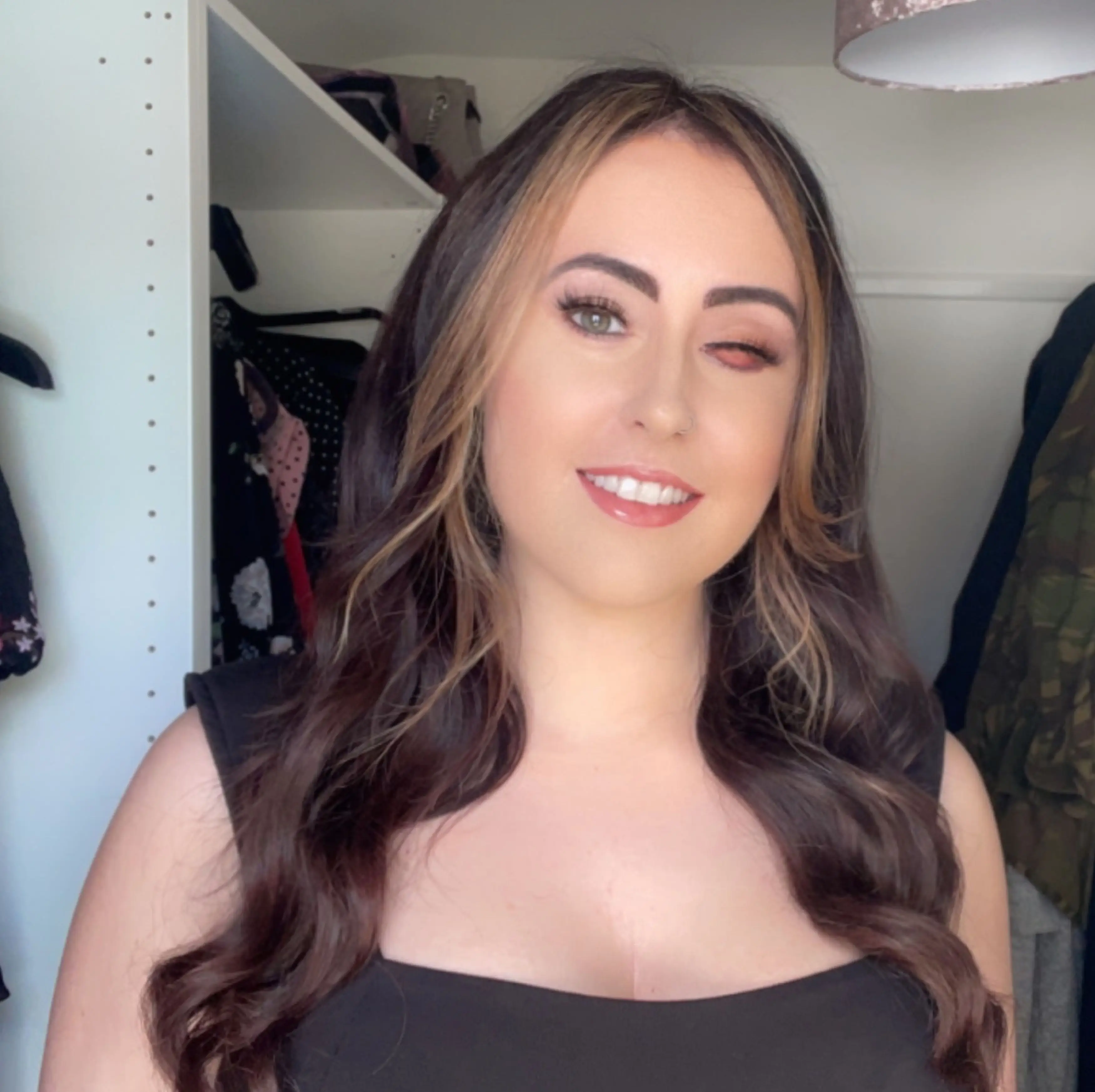 Danni used to get bullied and wouldn't ever take her prosthetic eye out.