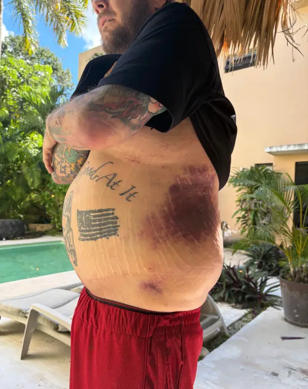 Rick claims to have paid his son's medical bills. (GoFundMe)