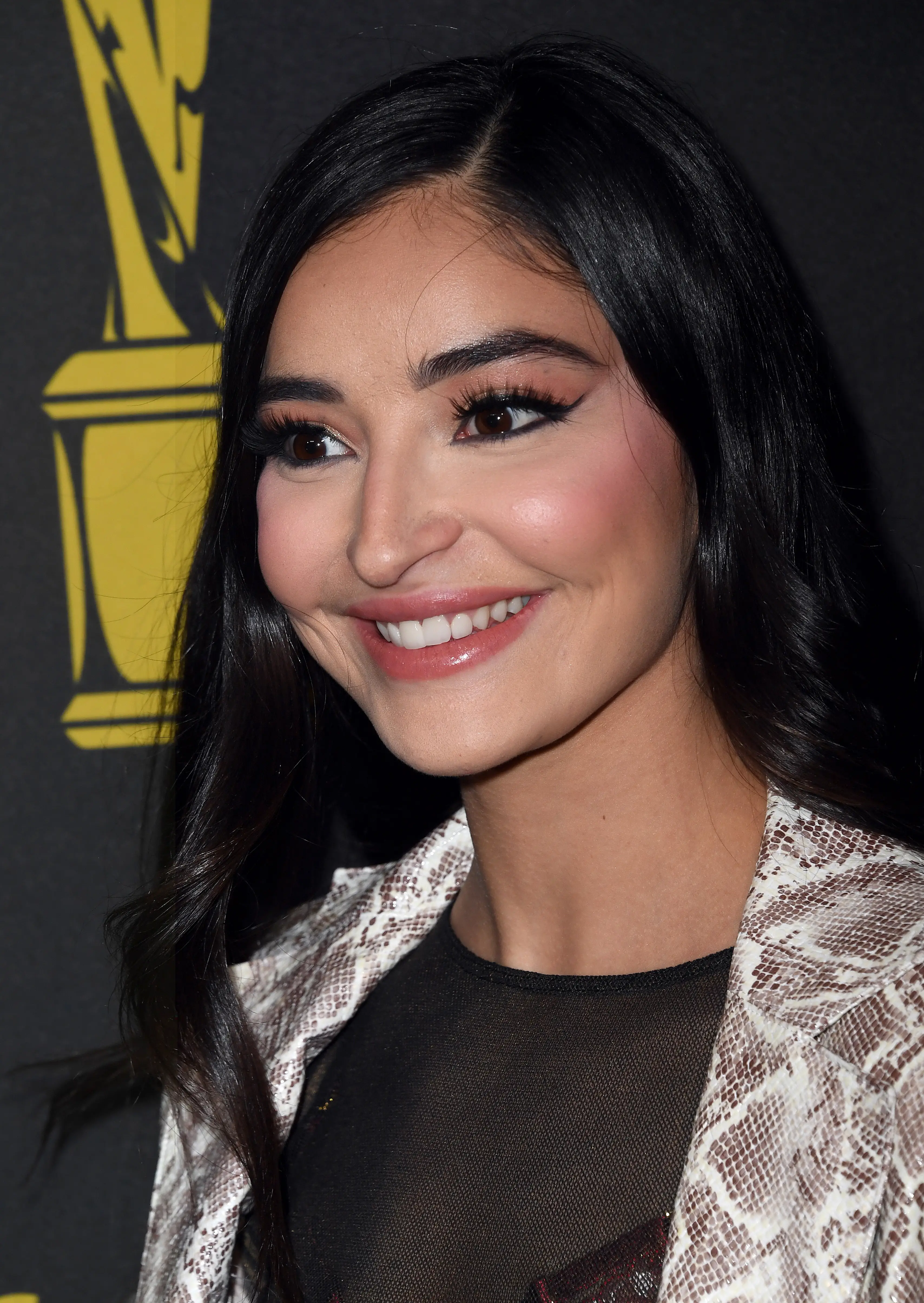 The 27-year-old's life was 'forever changed' by the incident, her lawyer said (Albert L. Ortega/Getty Images)