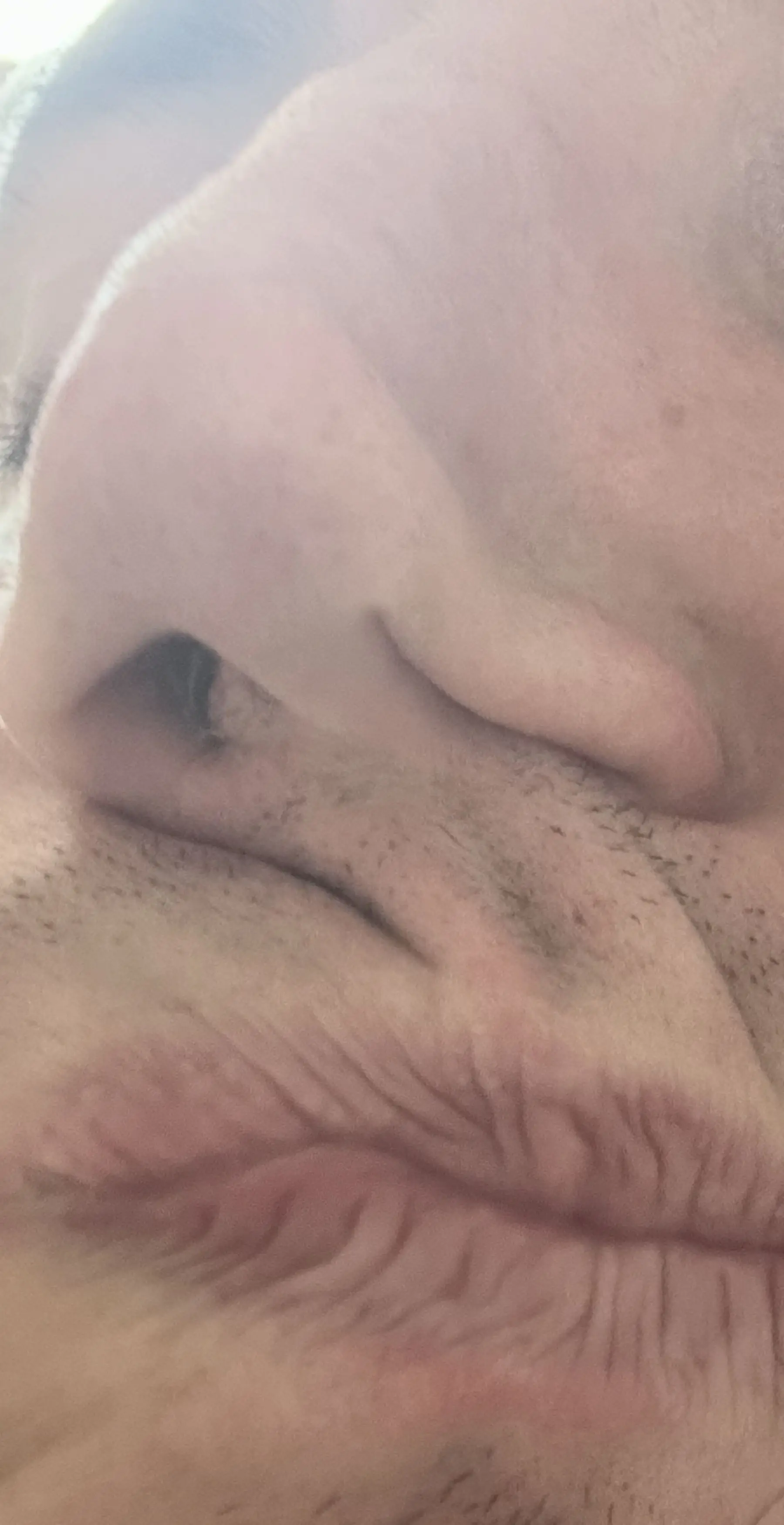 Bradley's nose has now collapsed after over a decade of cocaine abuse eroded his nasal cavity (Kennedy News and Media)