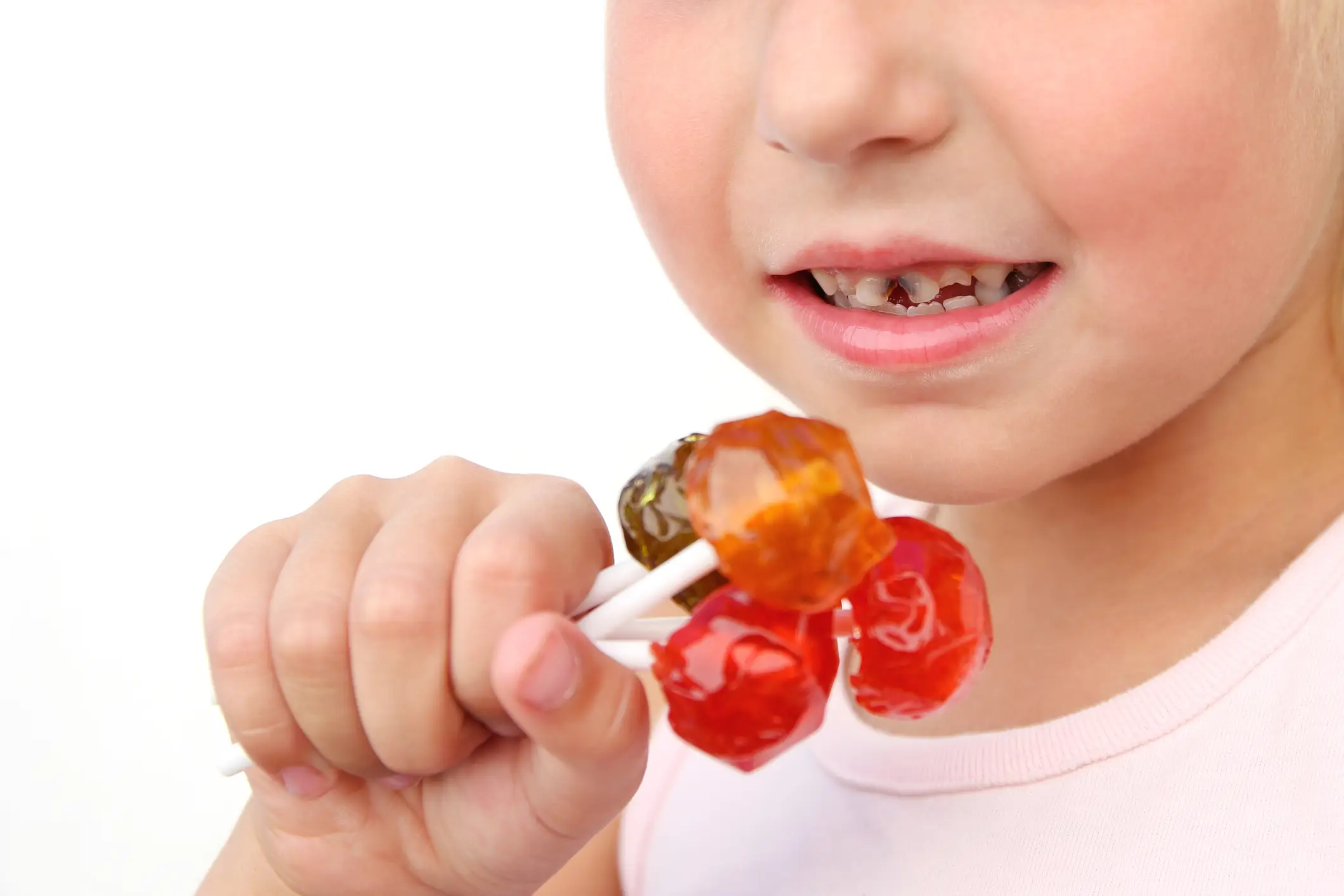 It's nothing to do with sugar or a lack of teeth brushing (Getty Stock)