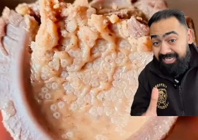 The medical professional says that it's no big deal. (Instagram/Drkaranrajan)