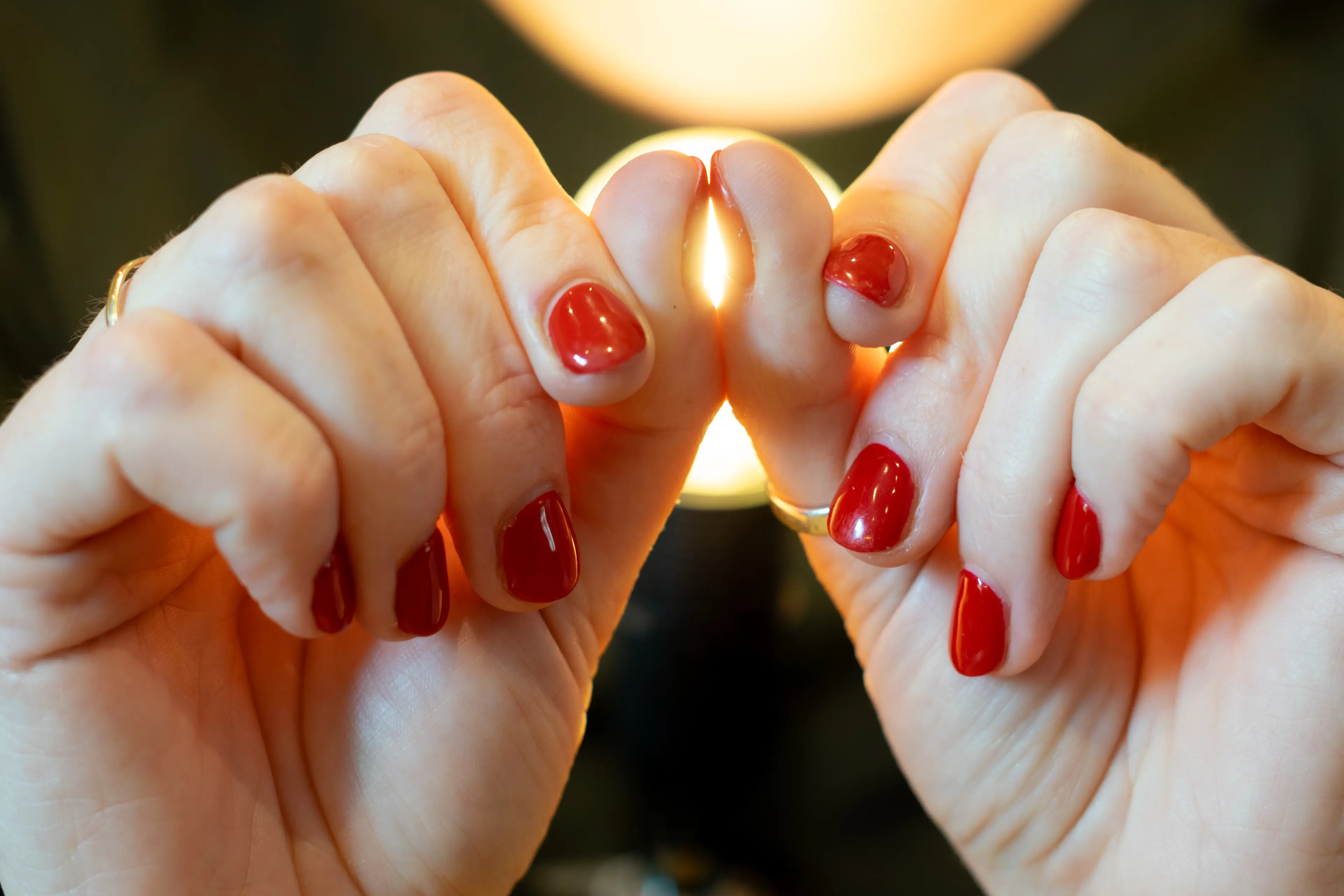 The Schamroth finger test, hold opposing fingers back to back and if there's no gap then it's a bad sign. (John Hewitt/Getty Images)