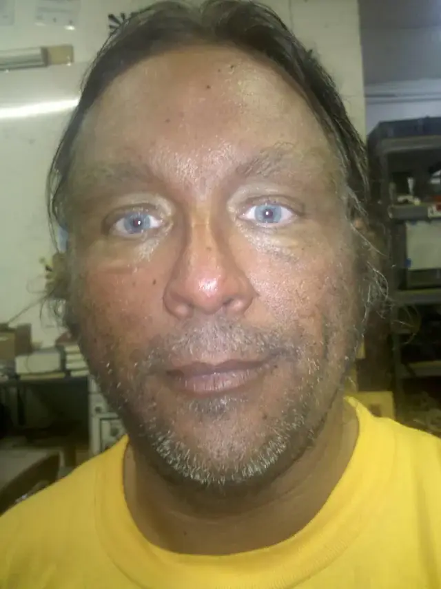 To no one's surprise, extreme tanning is discouraged (Reddit/n3glv)