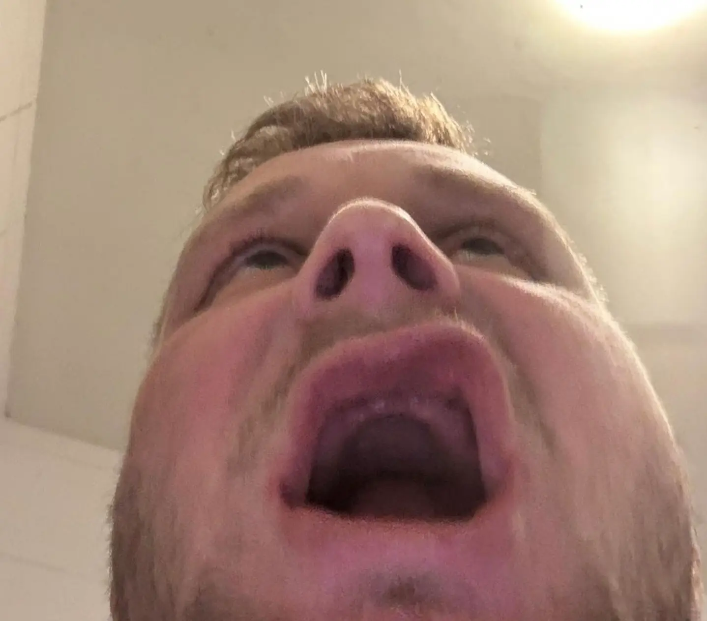 He has been left without 'any functional teeth' (Kennedy News and Media)