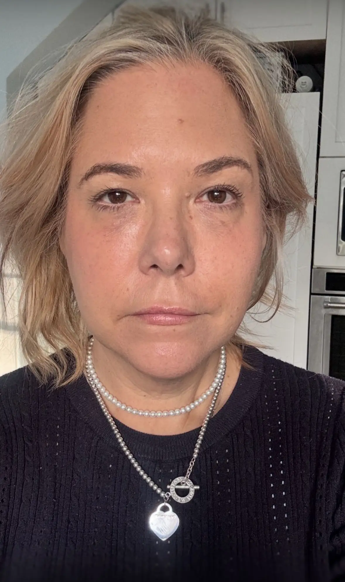 Krista Alise said people constantly asked her if she 'was tired' prior to going under the knife (PA Real Life)