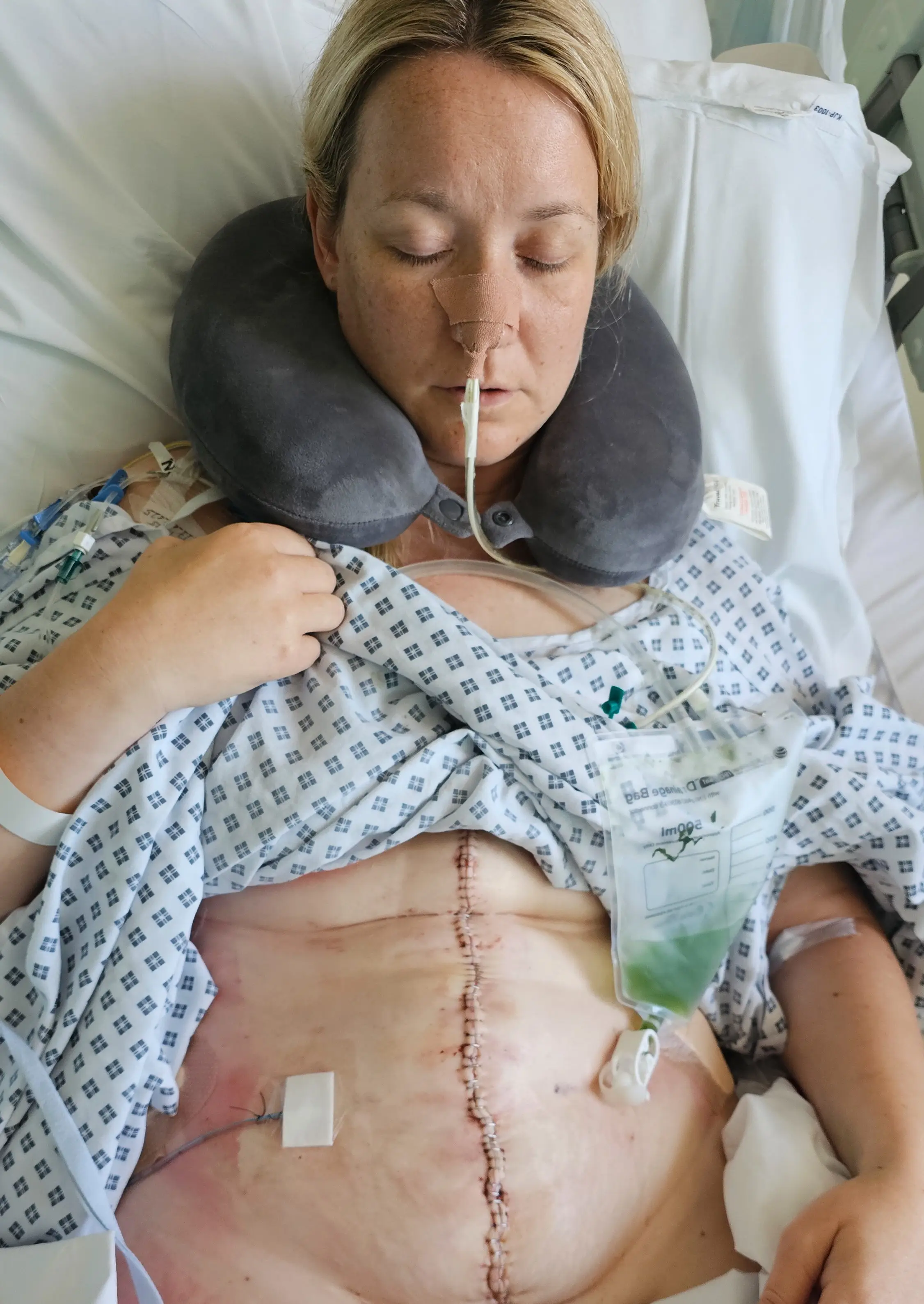 She would need extensive surgery to remove nine of her organs
(SWNS)