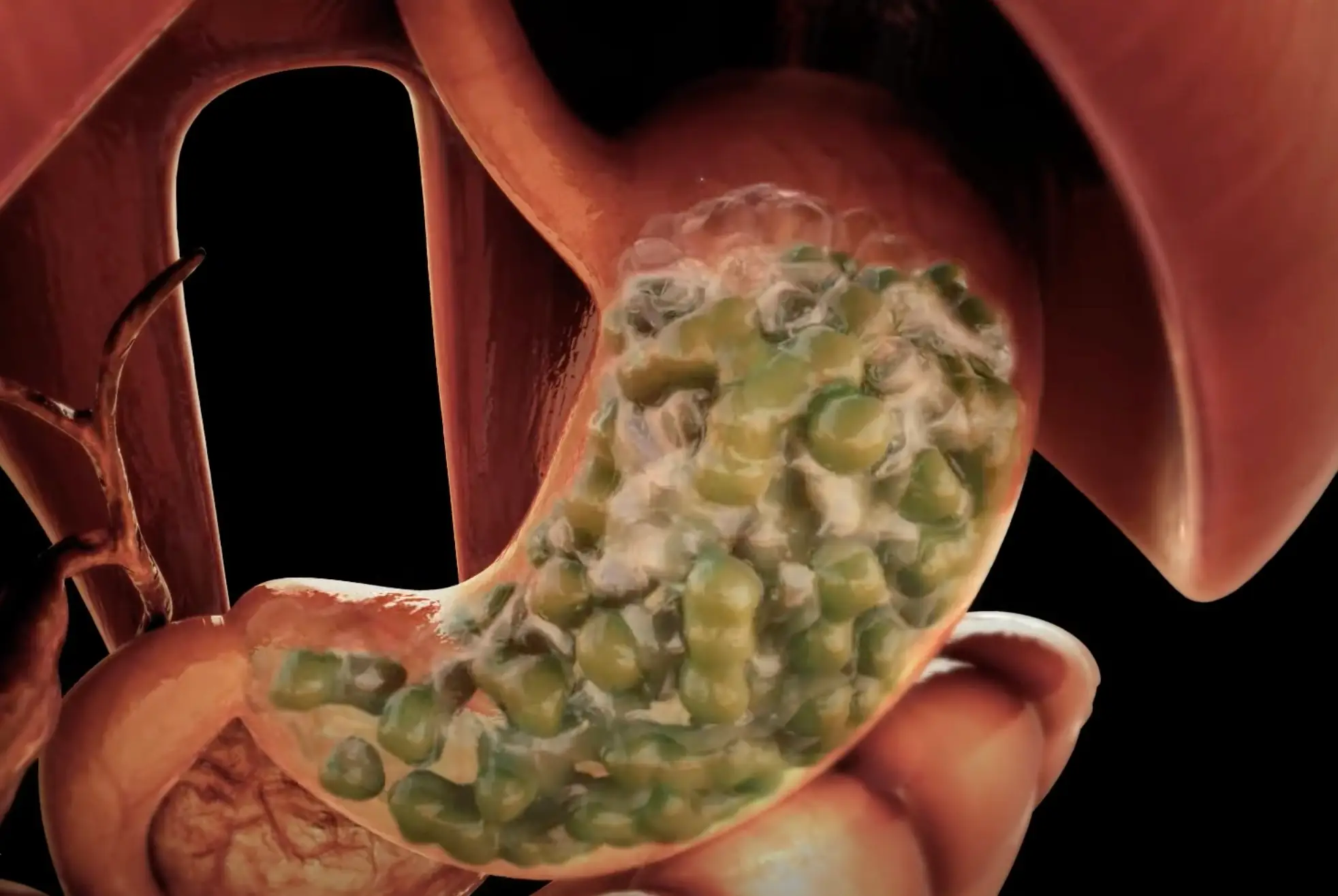 The health experts explained that food helps 'trap' the booze in your stomach, rather than letting it straight into the small intestine (YouTube/Dandelion Medical Animation)