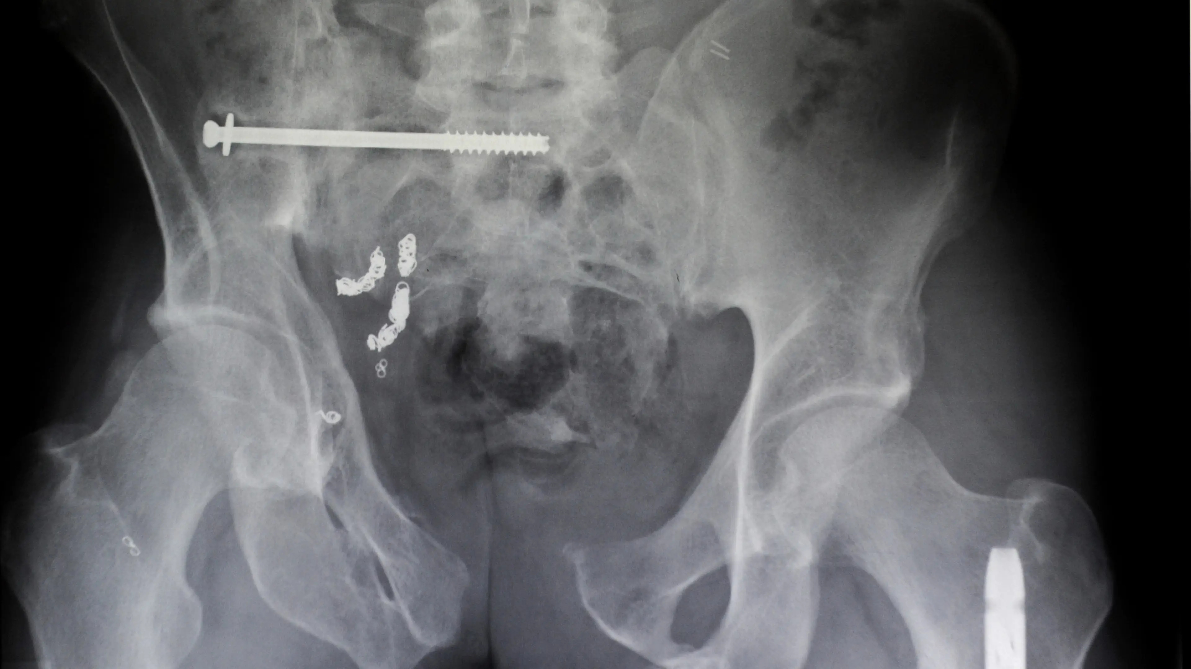 Ron Antonelli/NY Daily News Archive via Getty Images