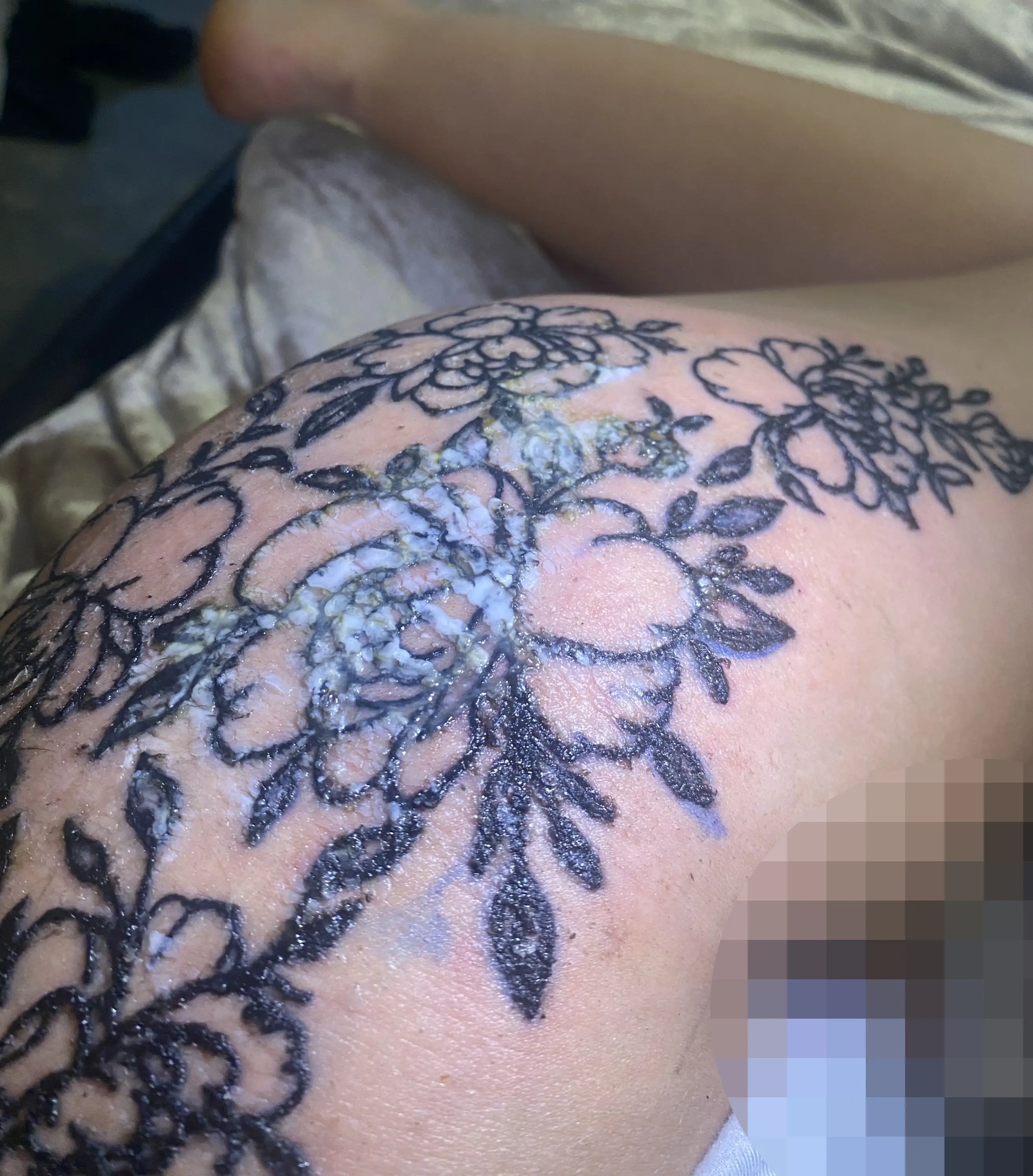 Painful pictures show how her inking became infected (Kennedy News and Media)