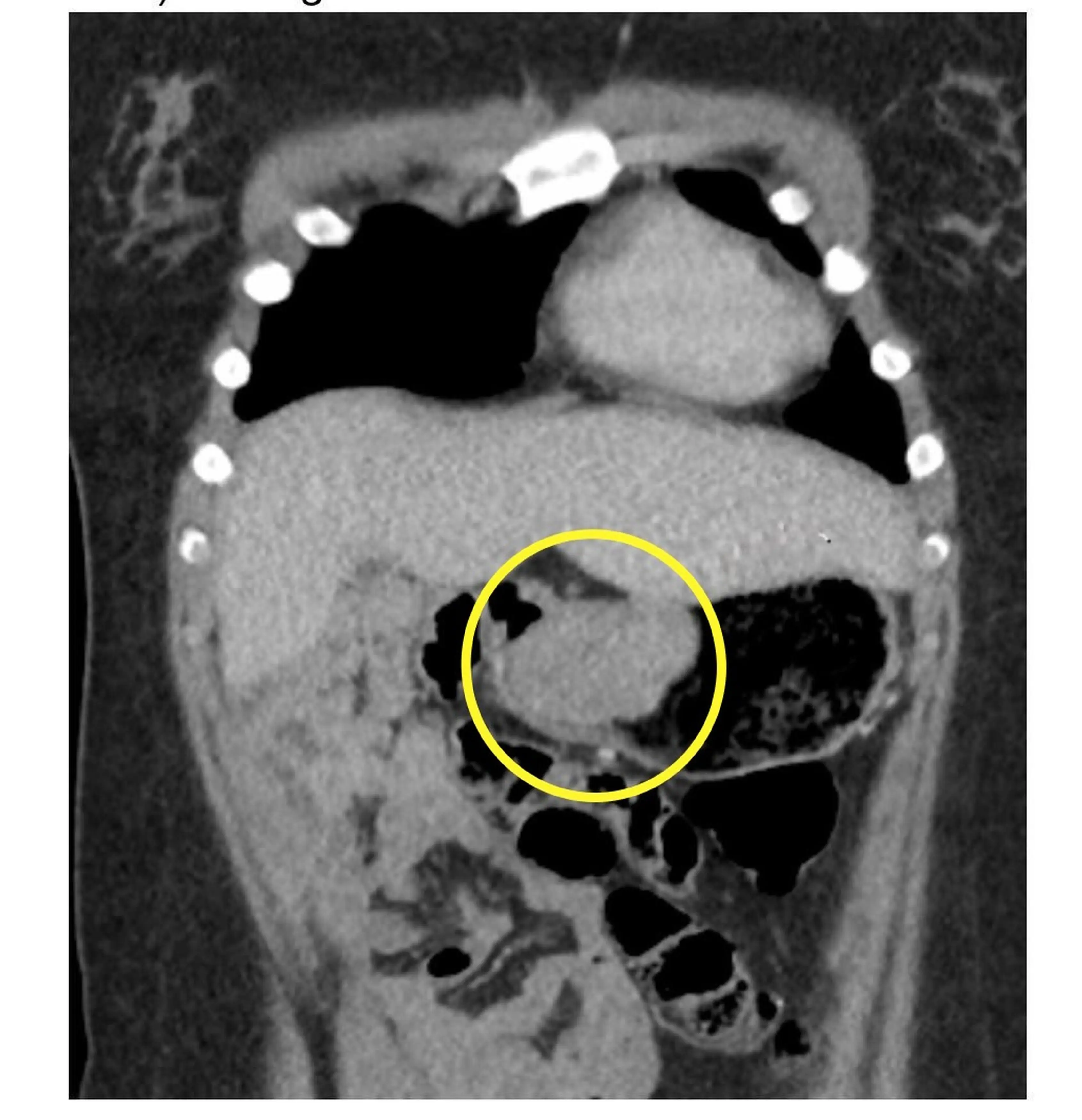 Bella had a large tumour in her stomach. (Kennedy News and Media)