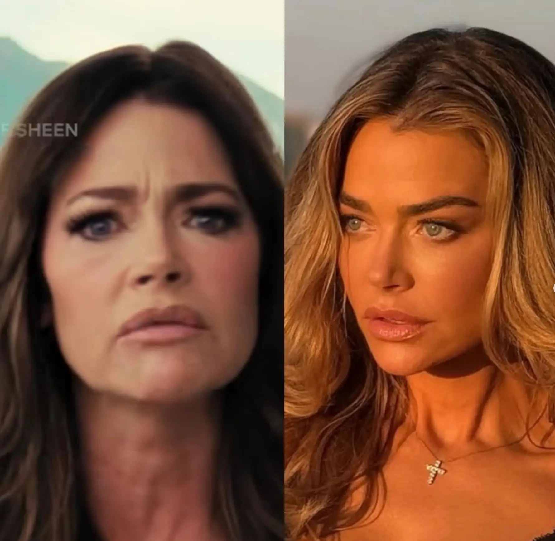 The plastic surgeon shared more before-and-after images of Denise Richards' transformation (Instagram/@drbentalei)