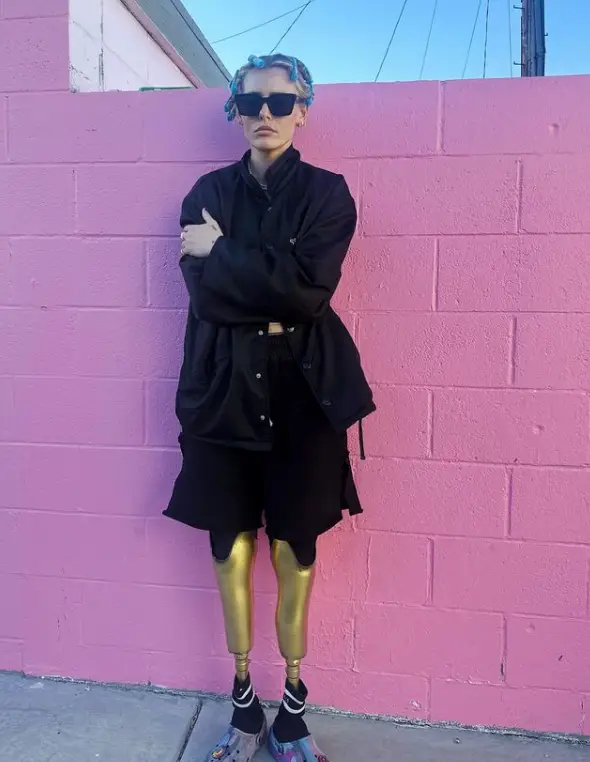 Lauren was just 24 when she contracted Toxic Shock Syndrome. (Instagram/@theimpossiblemuse)