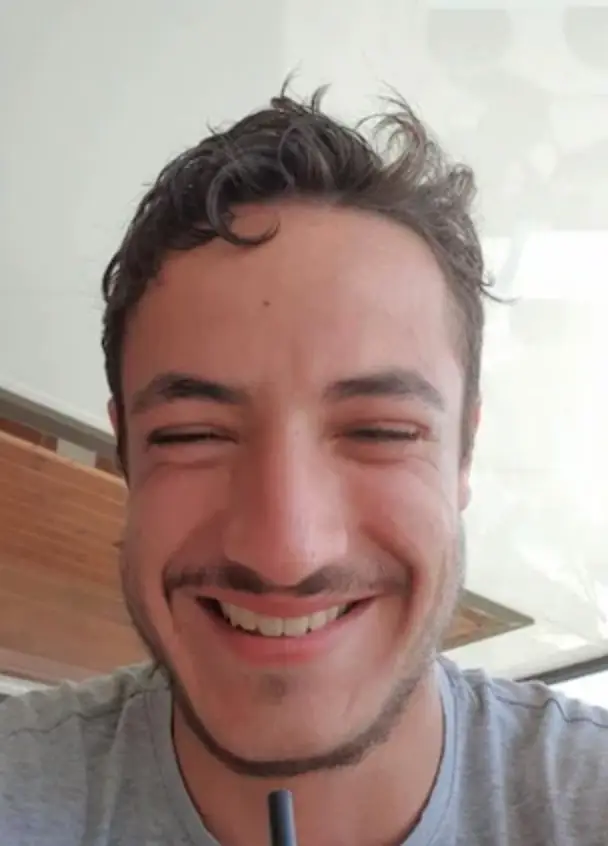 Mathieu Vigier Latour went to Istanbul with the intention of getting a beard transplant (Family Handout)