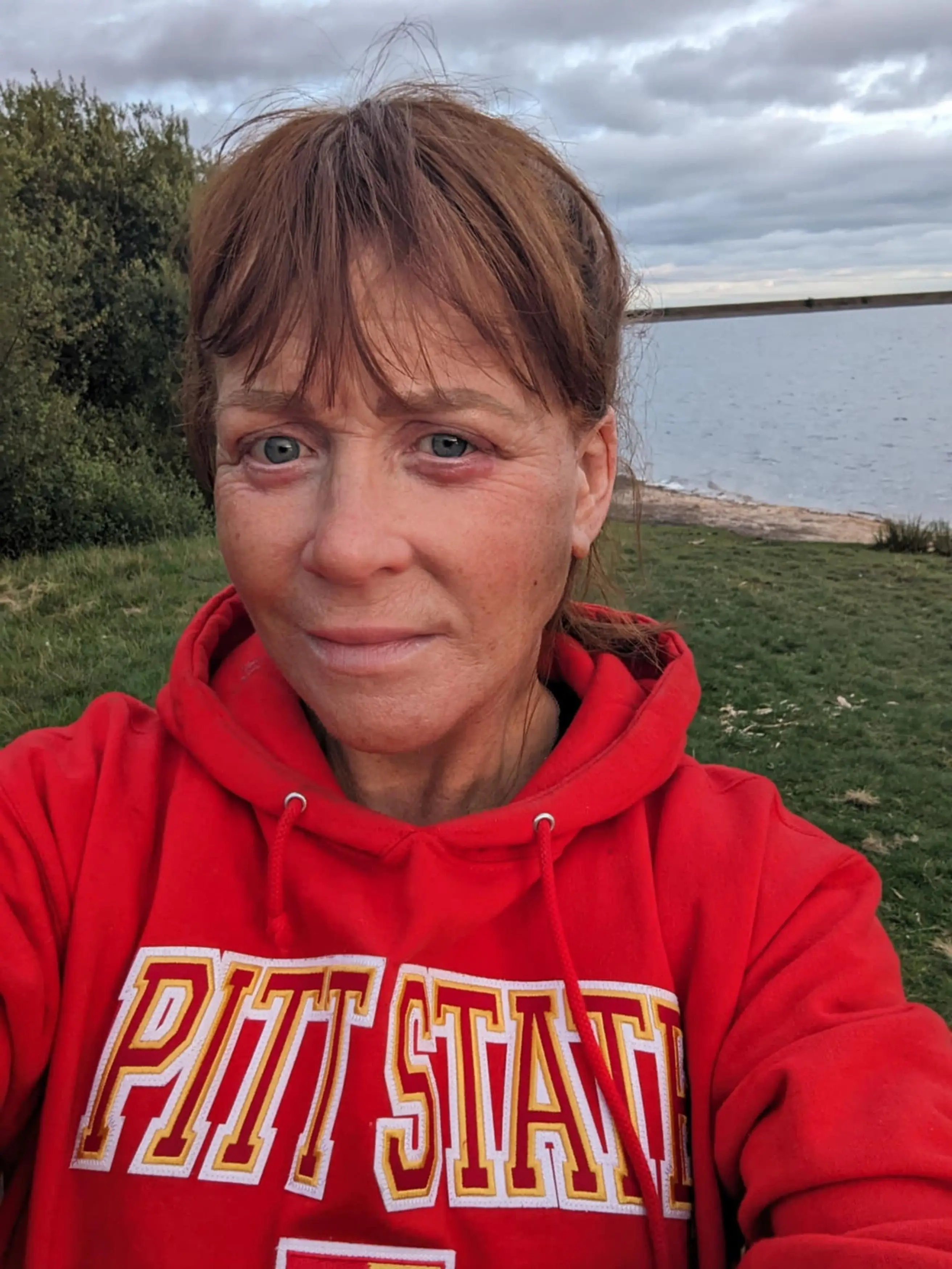 She saved around £5,200 for the surgery (Kennedy News and Media)