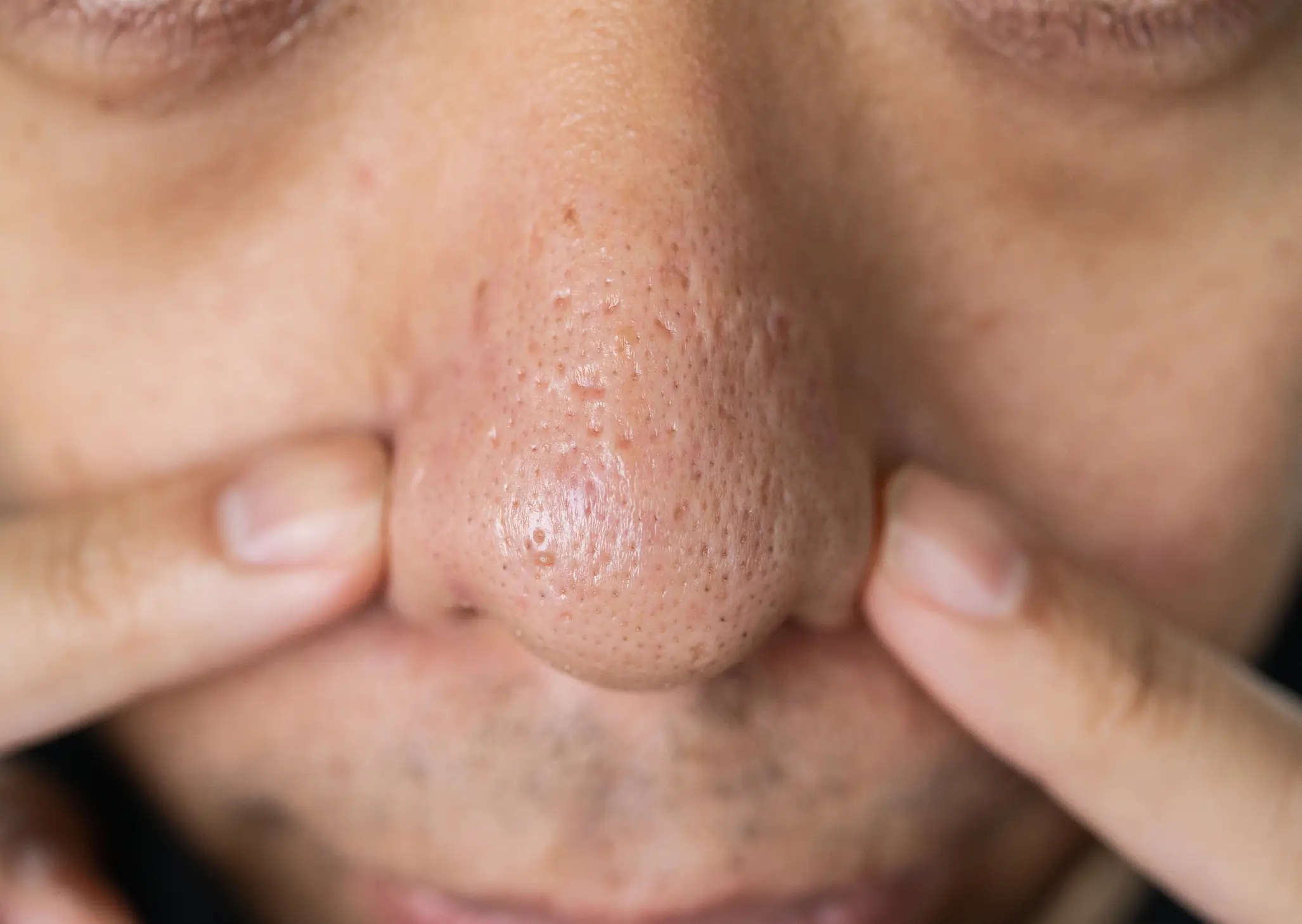 Just leave them alone, people (Getty Stock Photo)