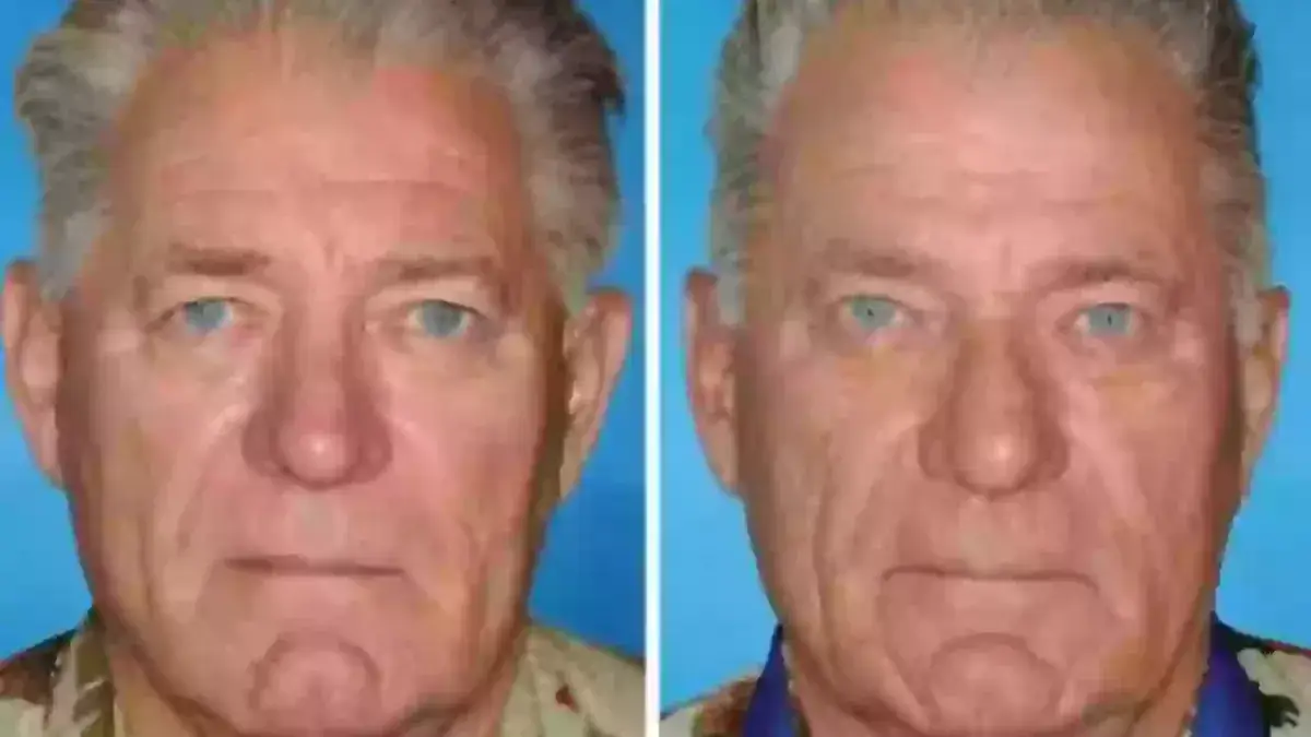 American Society of Plastic Surgeons