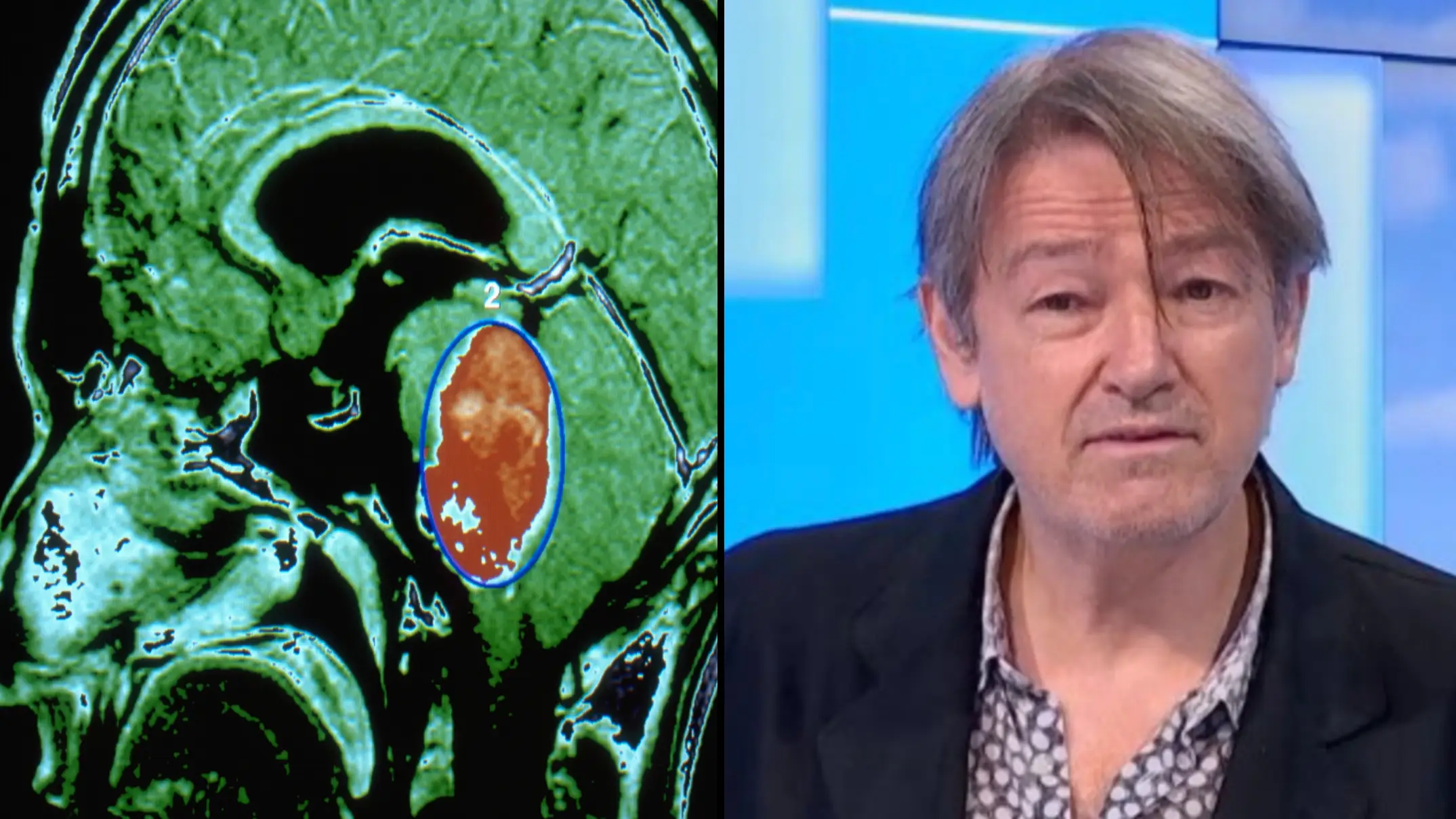 Getty Stock Photo/France 3TV