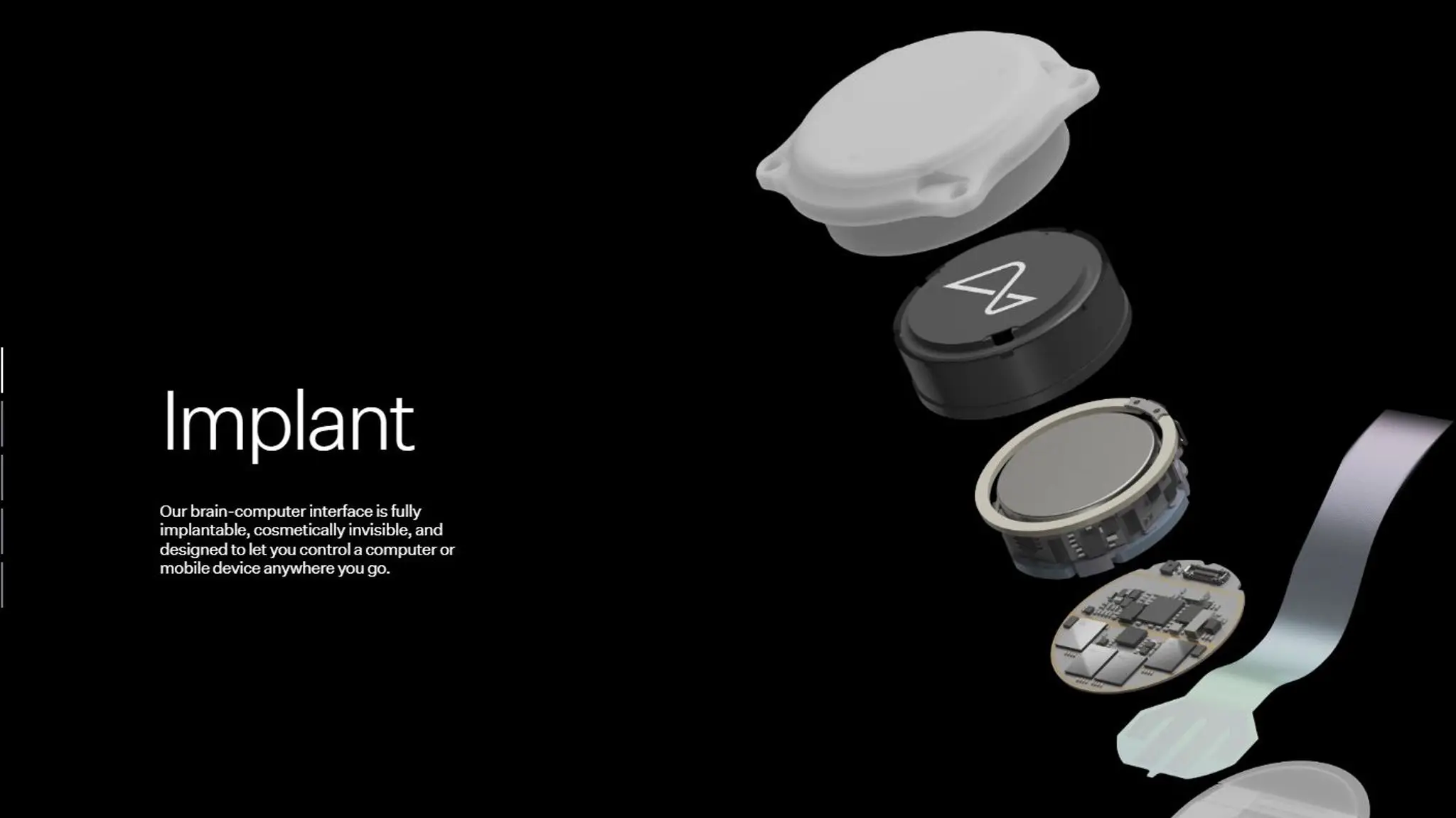 The brain chip could transform the lives of people with severe impairments.