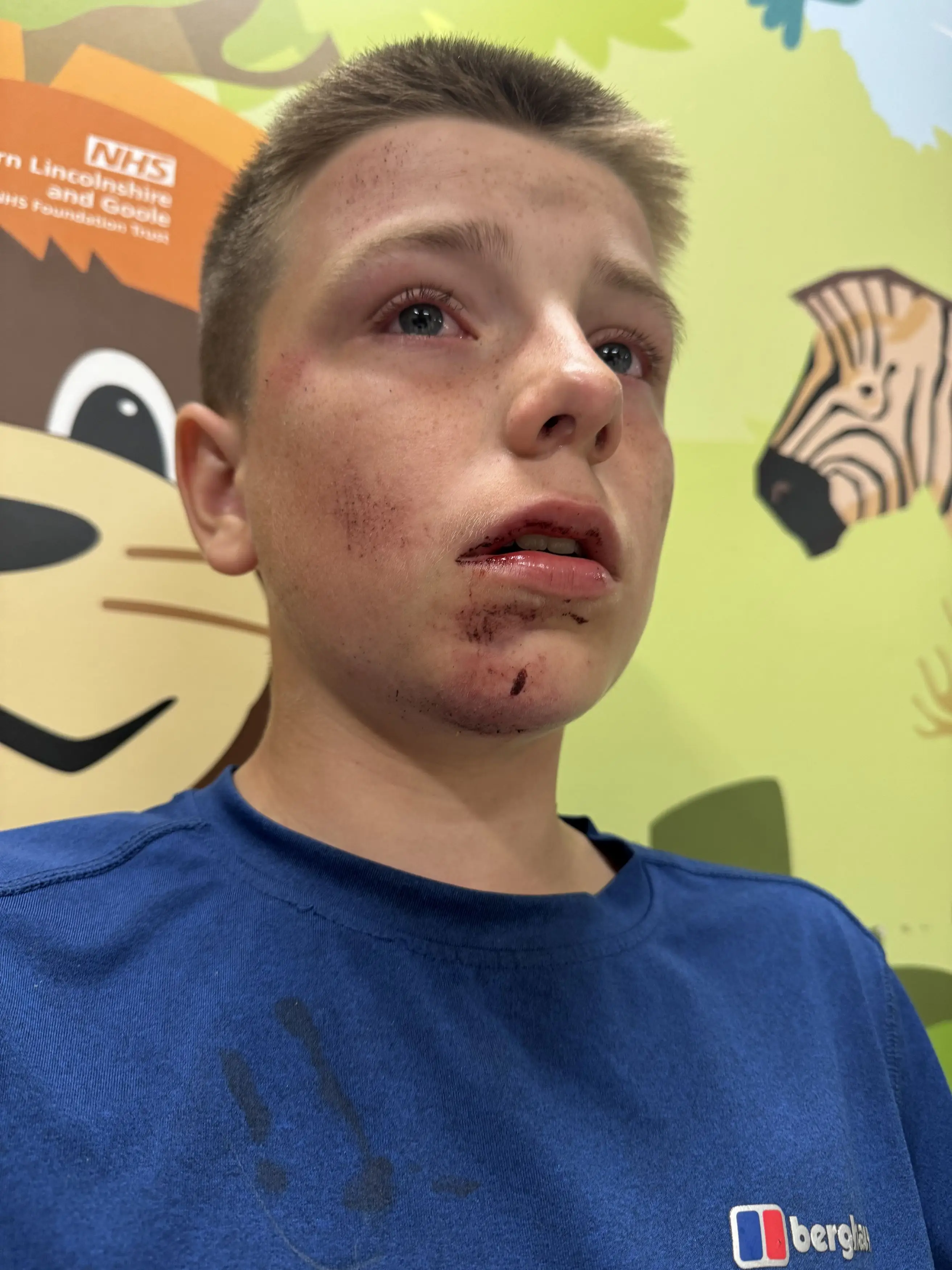 Teenager Lucas passed out for 20 seconds while doing the 'tap out' challenge with friends in a park (Kennedy News and Media)