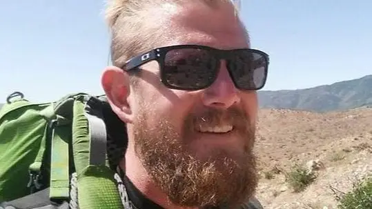 Man burnt thumb while cooking and was then told both his legs needed to be amputated