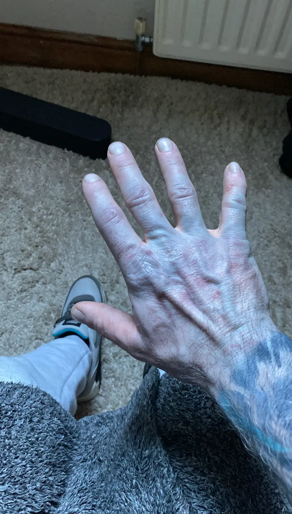 Tommy was bright blue when he visited the hospital (Facebook/Tommy Lynch)