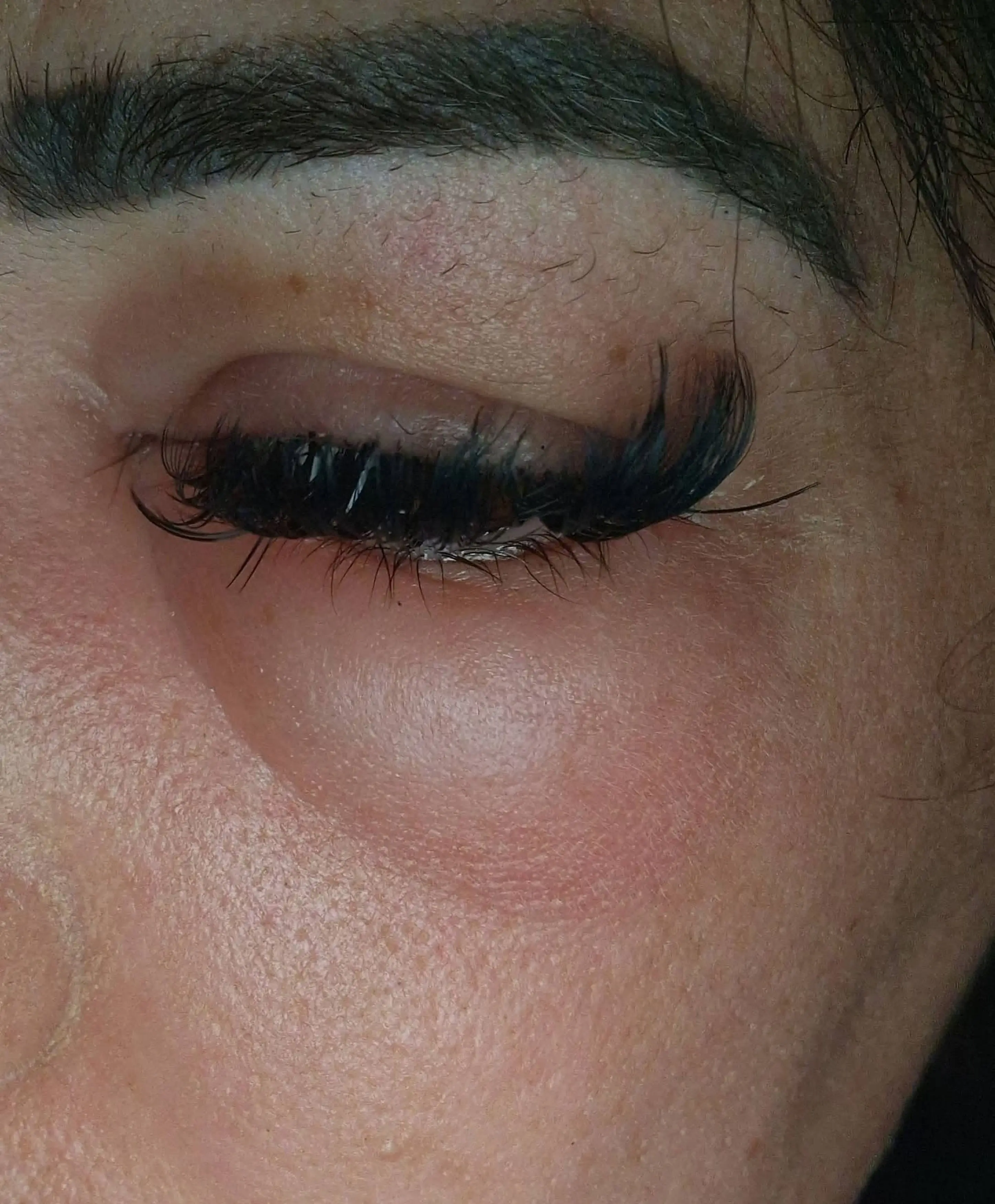 Complications from the procedures also left her fighting a potentially life-threatening blood infection (Kennedy News and Media)