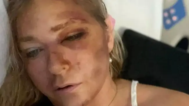 Bus driver speaks out on Virginia Giuffre bus crash that 'left her with days to live' 