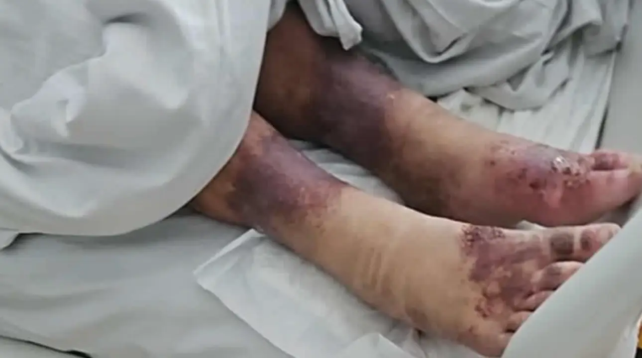 The woman was 'days' away from dying when she was found (Pomagan.pl)