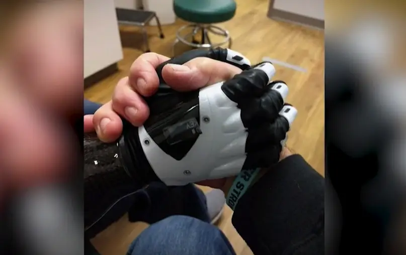 She has since made a recovery with the help of prosthetics (Marie Trainer)