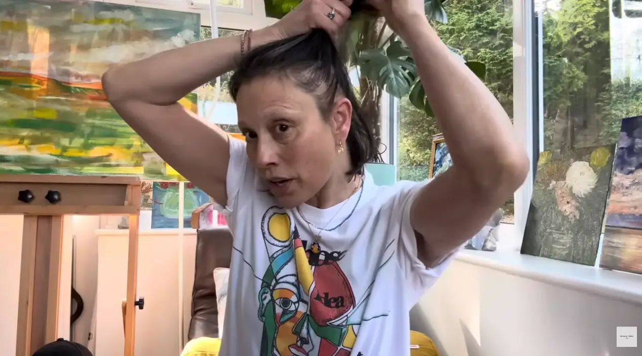 Melanie shared the impact of her alopecia back in April (Karwai Tang/WireImage)