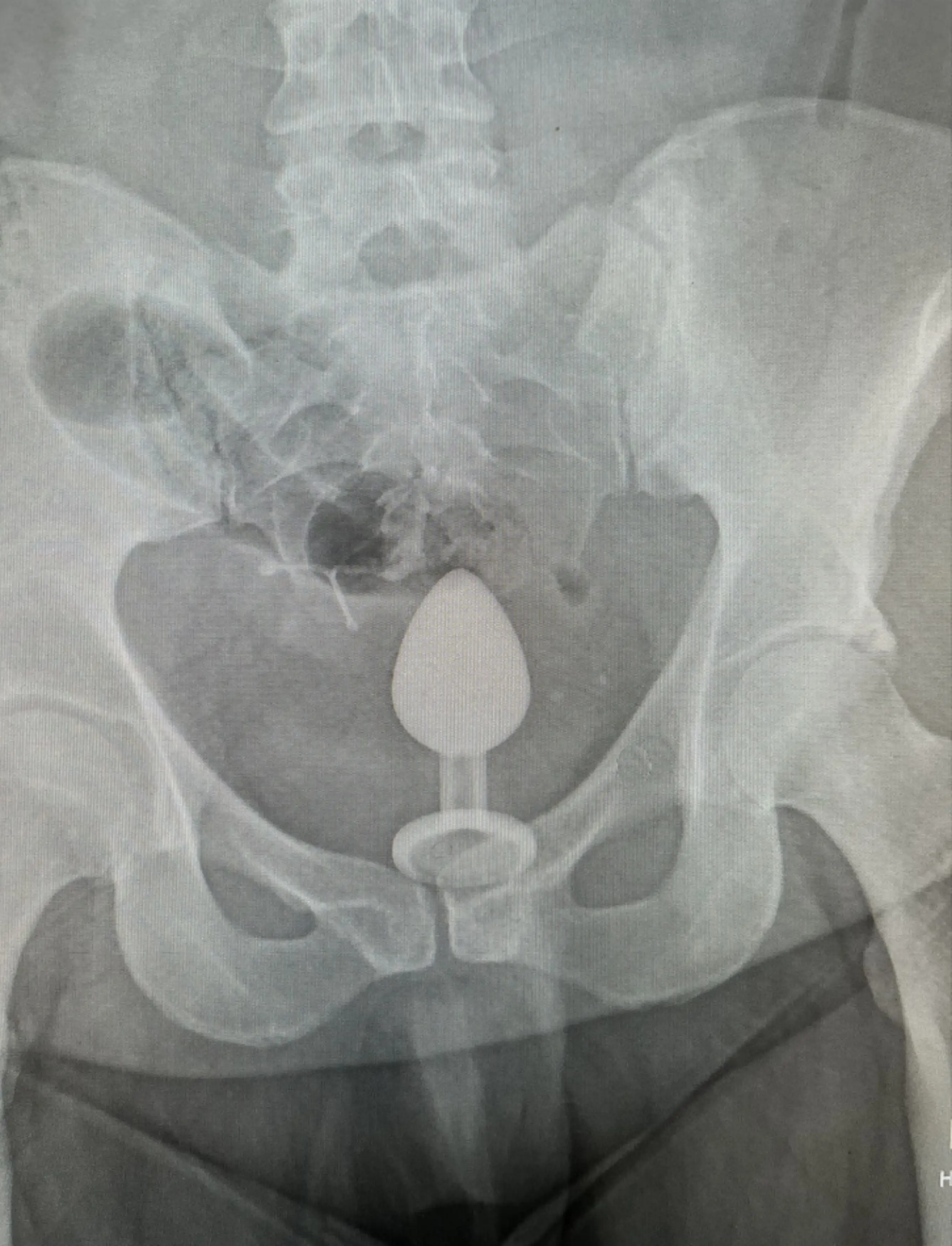 Gigi eventually made it to the hospital where an x-ray revealed the extent of her problems.