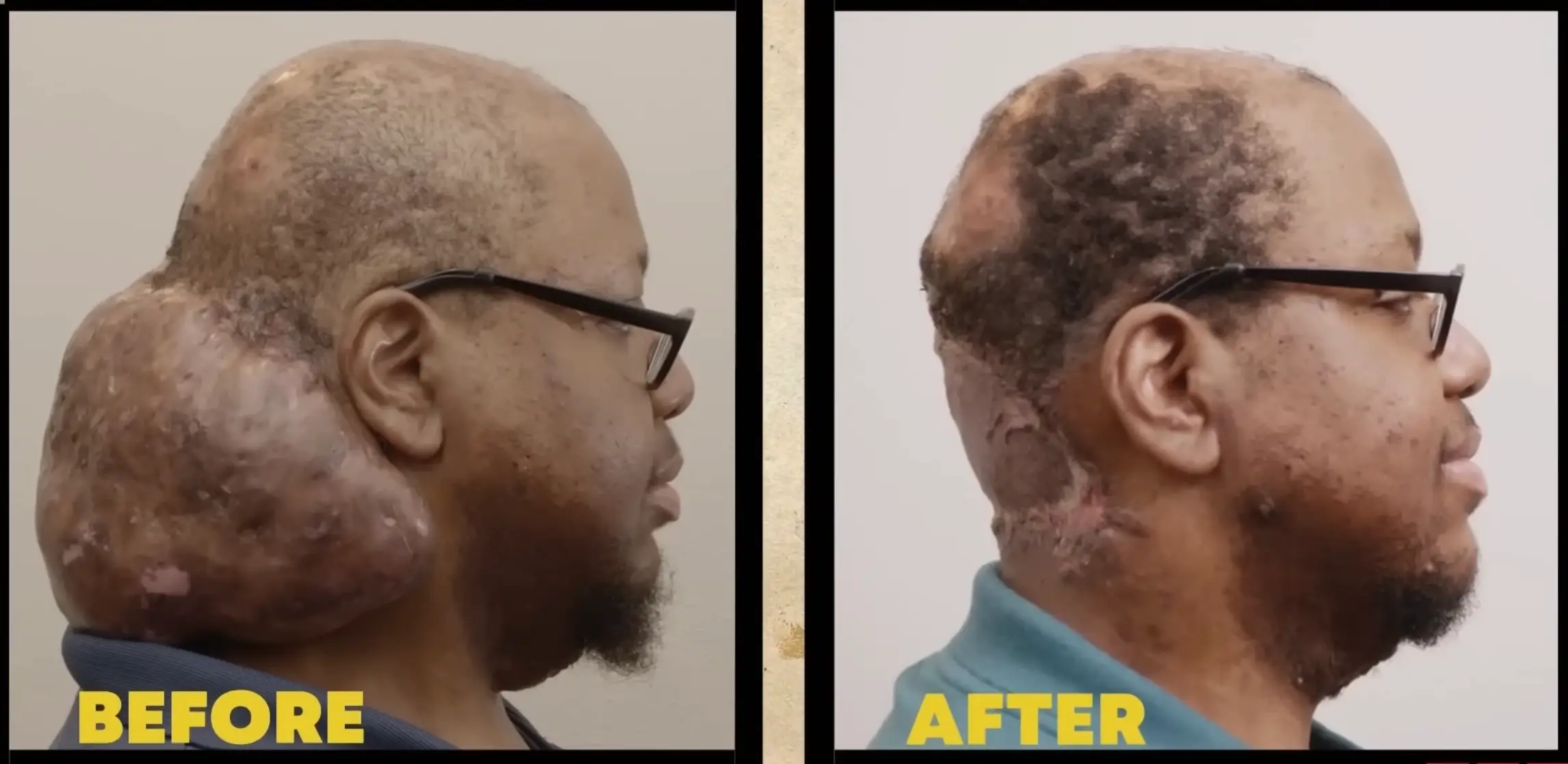 Dr Ryan Osborne did an incredible job on Arlin (TLC)