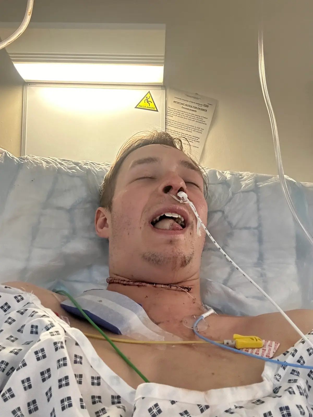 Dan had to undergo a gruelling surgery to get rid of the tumours (SWNS)
