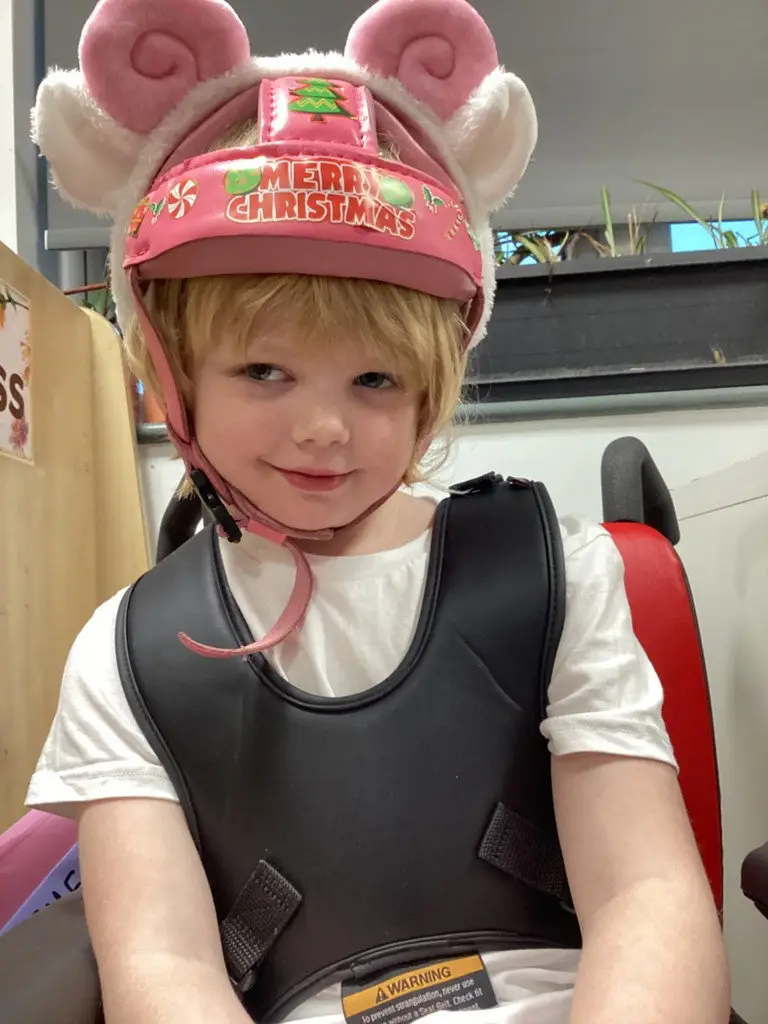 Holly has to undergo bi-weekly treatment to slow down the effects of her condition (SWNS)